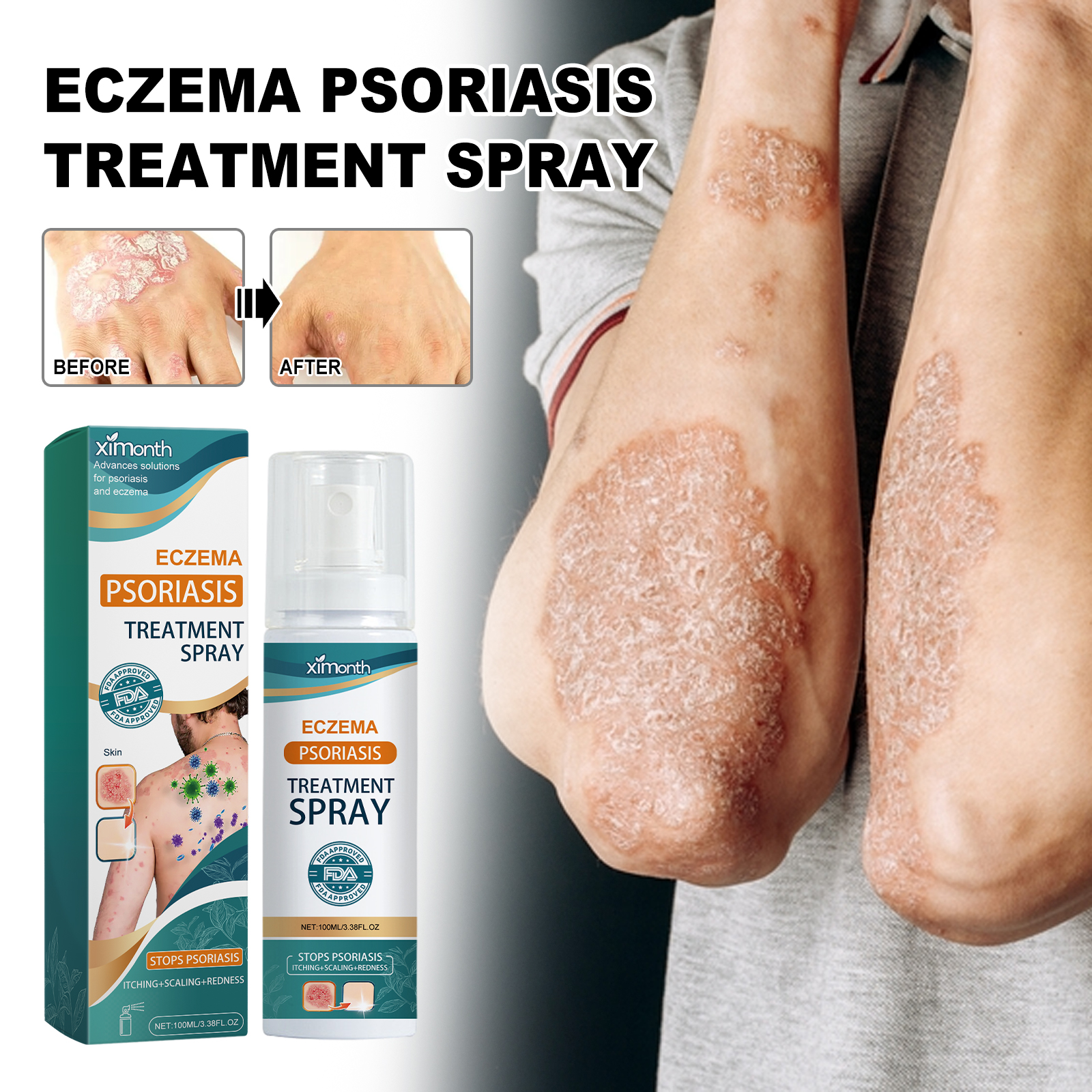 Skin Repair Spray Soothing Itching Redness Peeling Relief For Hands Feet Tinea Fungus Care Daily Skin Treatment