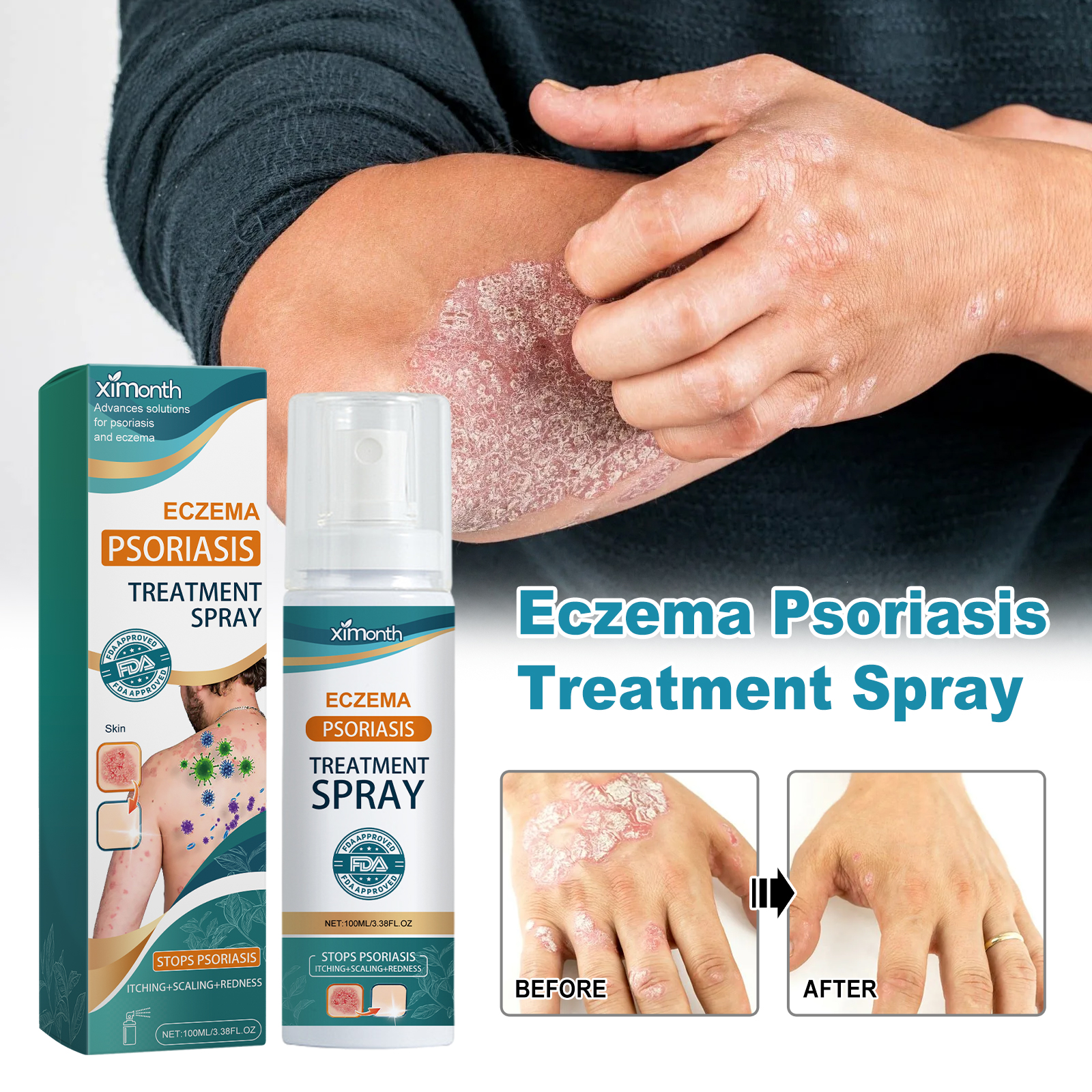 Skin Repair Spray Soothing Itching Redness Peeling Relief For Hands Feet Tinea Fungus Care Daily Skin Treatment