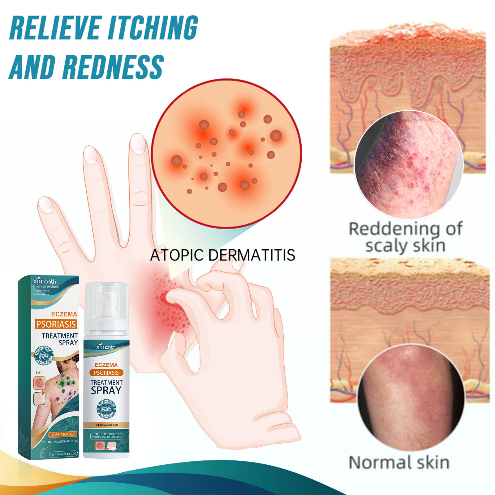 Skin Repair Spray Soothing Itching Redness Peeling Relief For Hands Feet Tinea Fungus Care Daily Skin Treatment