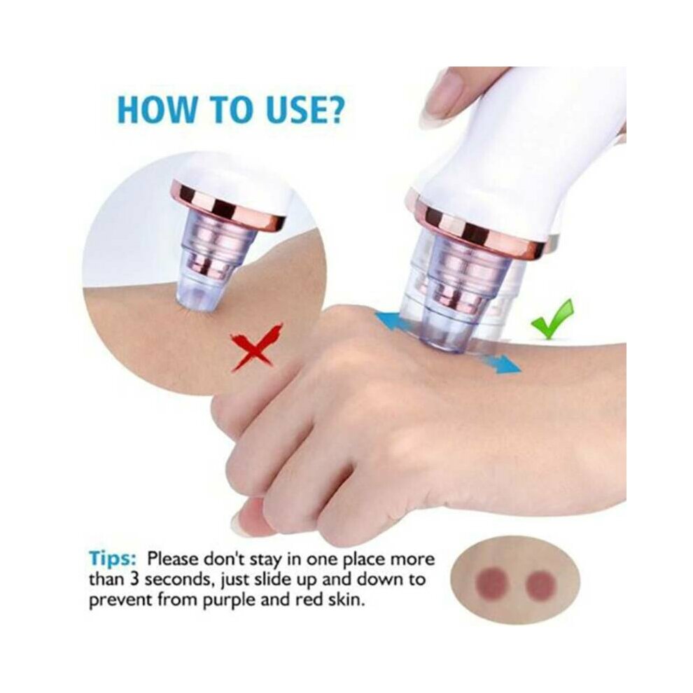 Electric Blackhead Remover Vacuum Acne Suction Facial Skin Deep Cleaner Machine