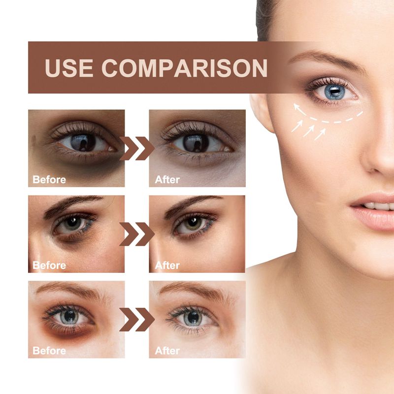 Dark Circle Anti-aging Rapid Reduction Eye Serum 20ml