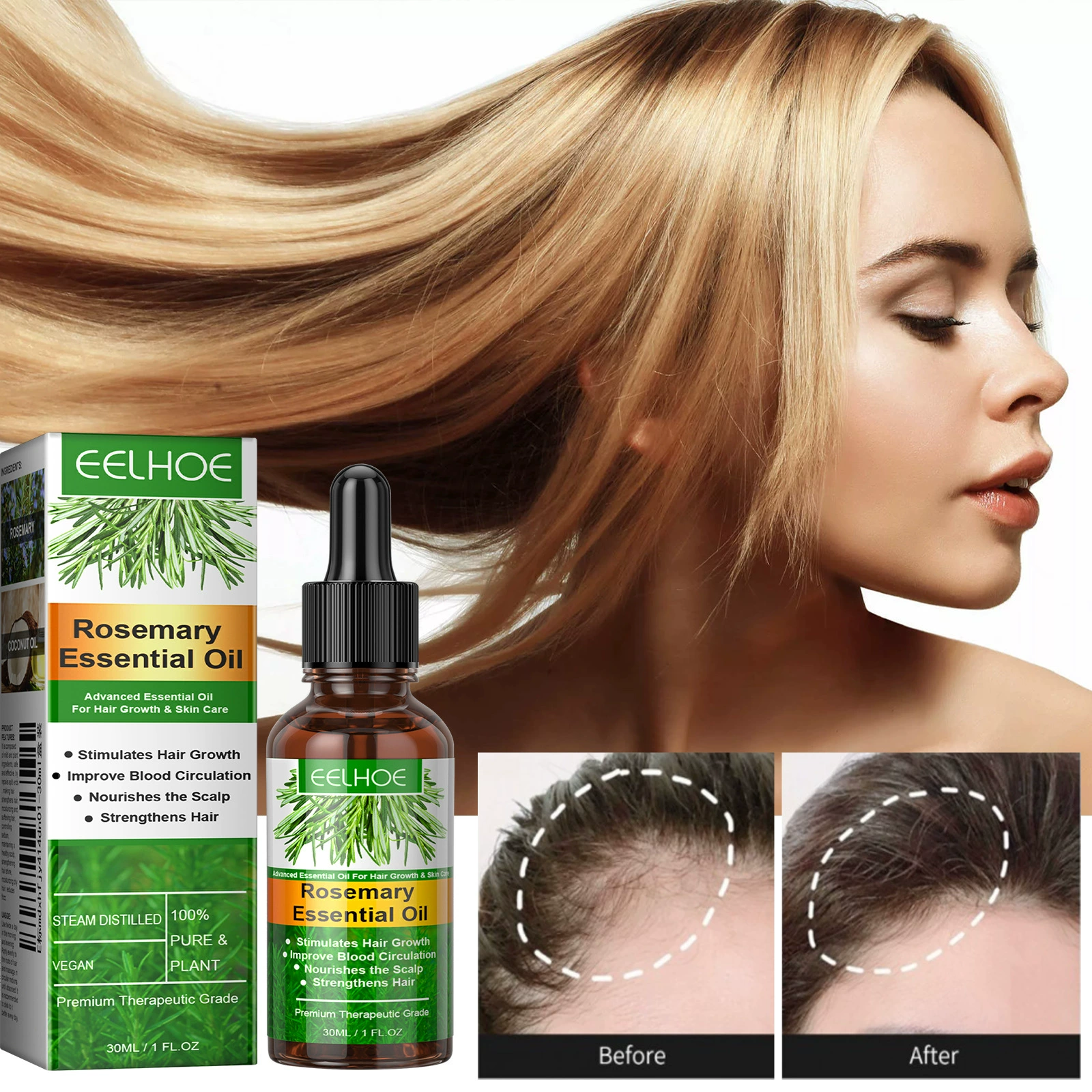 Rosemary Essential Oil Nourishes Repairs Improves Frizz Prevents Hair Loss