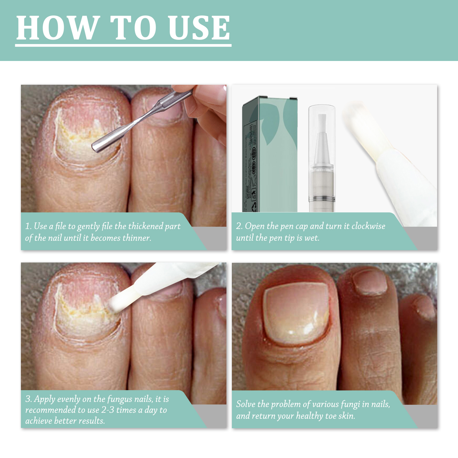 Nail Care Pen Cleansing Brightening Onychomycosis Care Liquid Thickened Onychomycosis Daily Care Tool