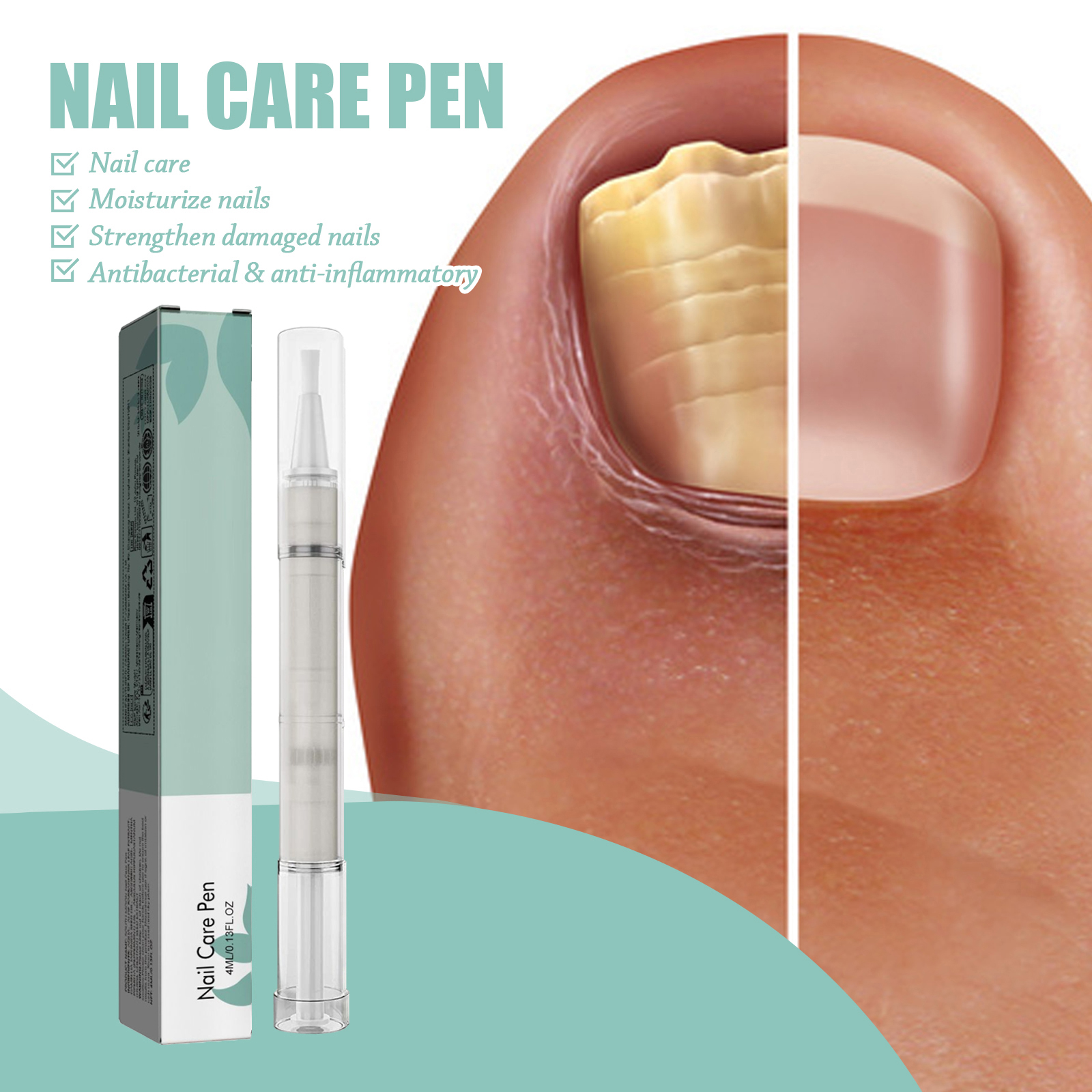 Nail Care Pen Cleansing Brightening Onychomycosis Care Liquid Thickened Onychomycosis Daily Care Tool