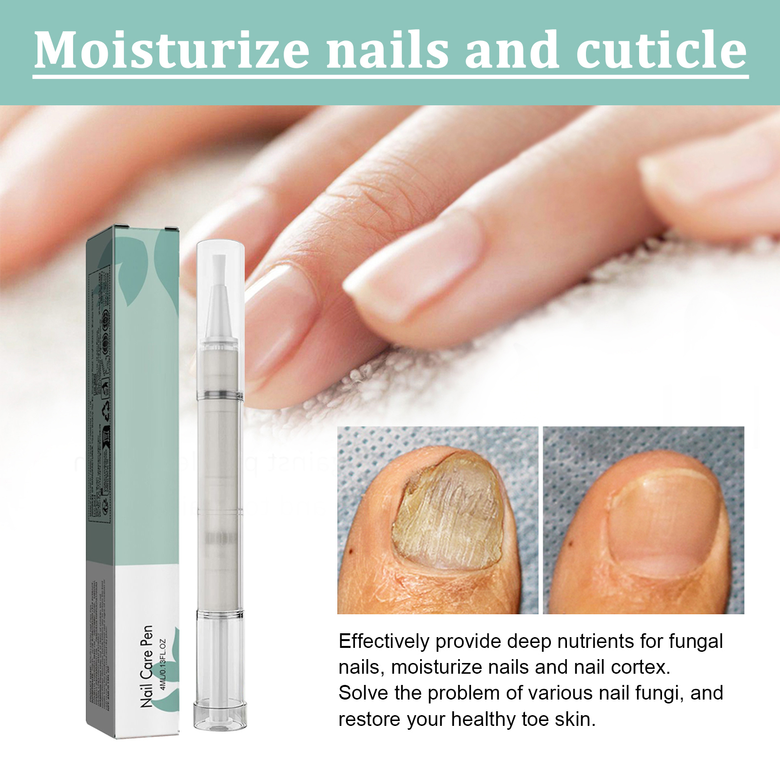 Nail Care Pen Cleansing Brightening Onychomycosis Care Liquid Thickened Onychomycosis Daily Care Tool
