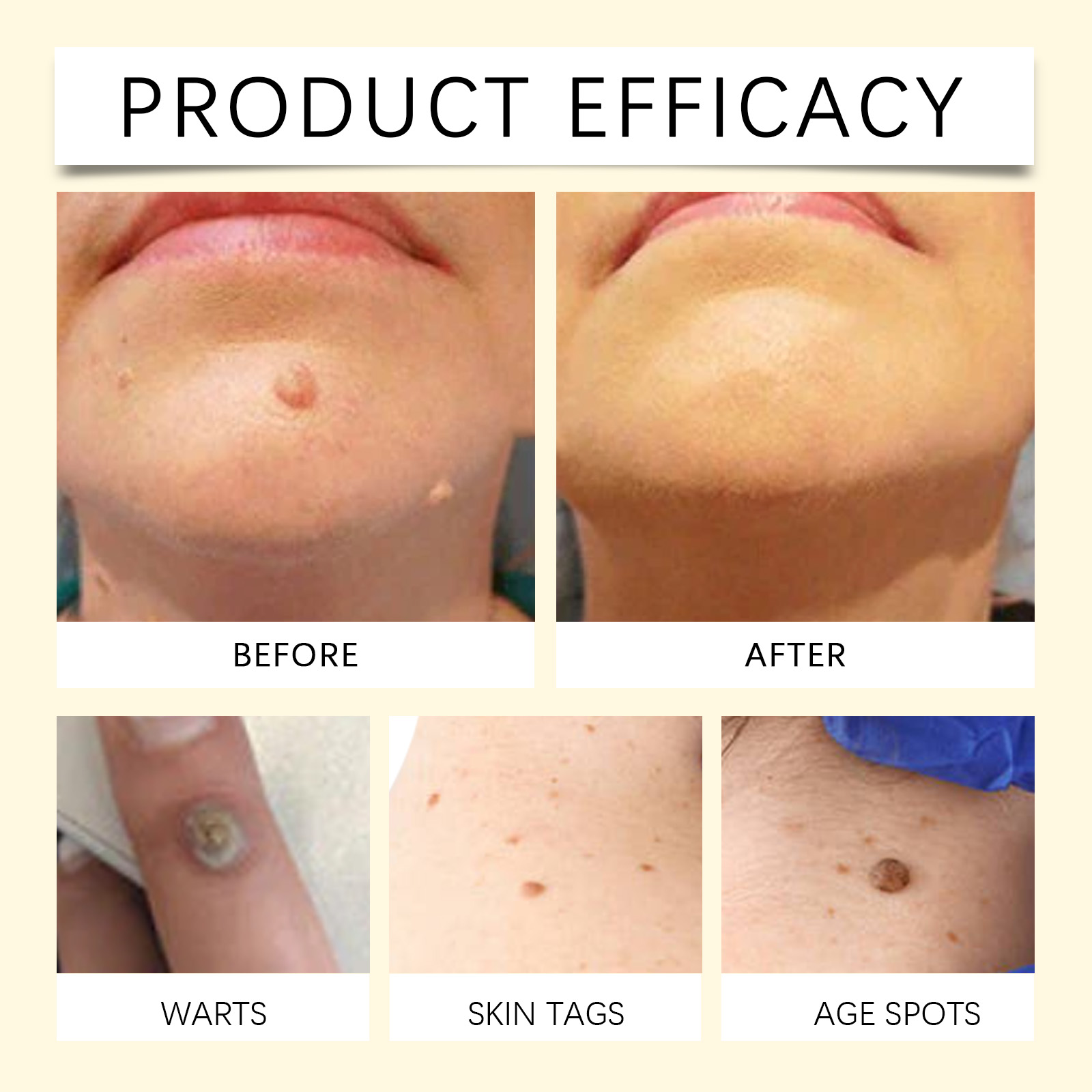 Bee Venom Skin Care Cream Mild Cleansing Smoothing Hydrating Moisturizing Firming Body Treatment