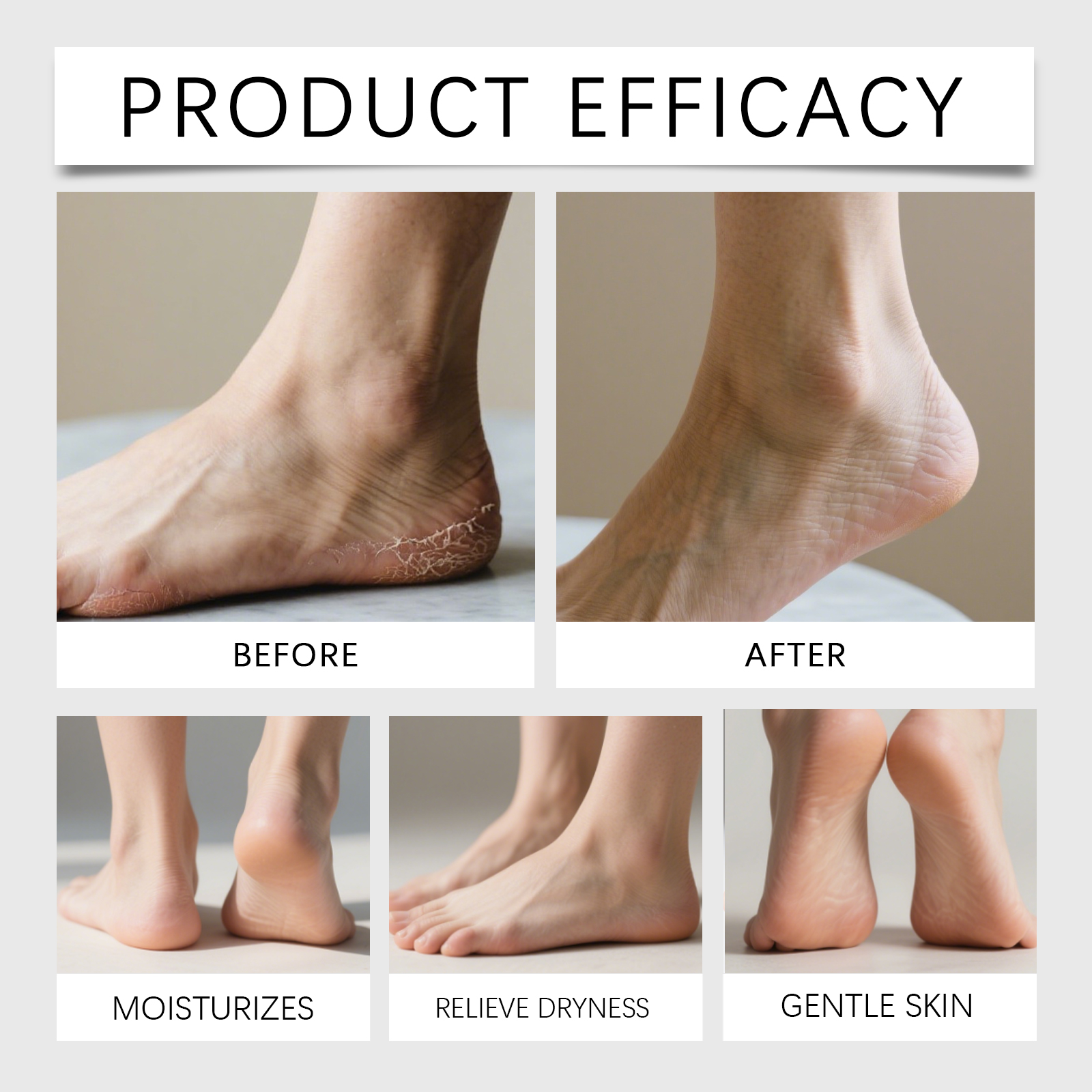 Turmeric Vitamin C Moisturizing Cream Nourishing Hydrating Dry Skin Foot Sole Autumn Winter Care