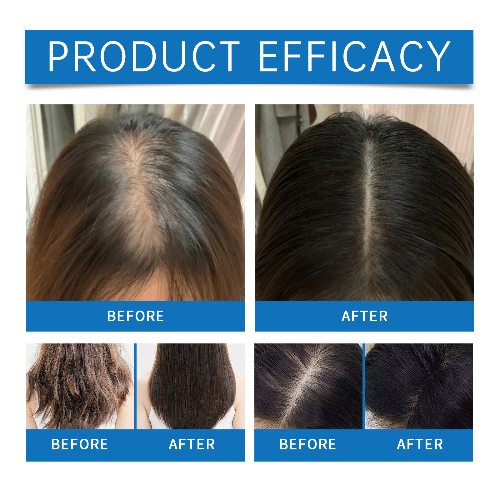 Hair Ball Essence Moisturizes Scalp Care Hydrating Smooth Shiny Hair Daily Massage Treatment
