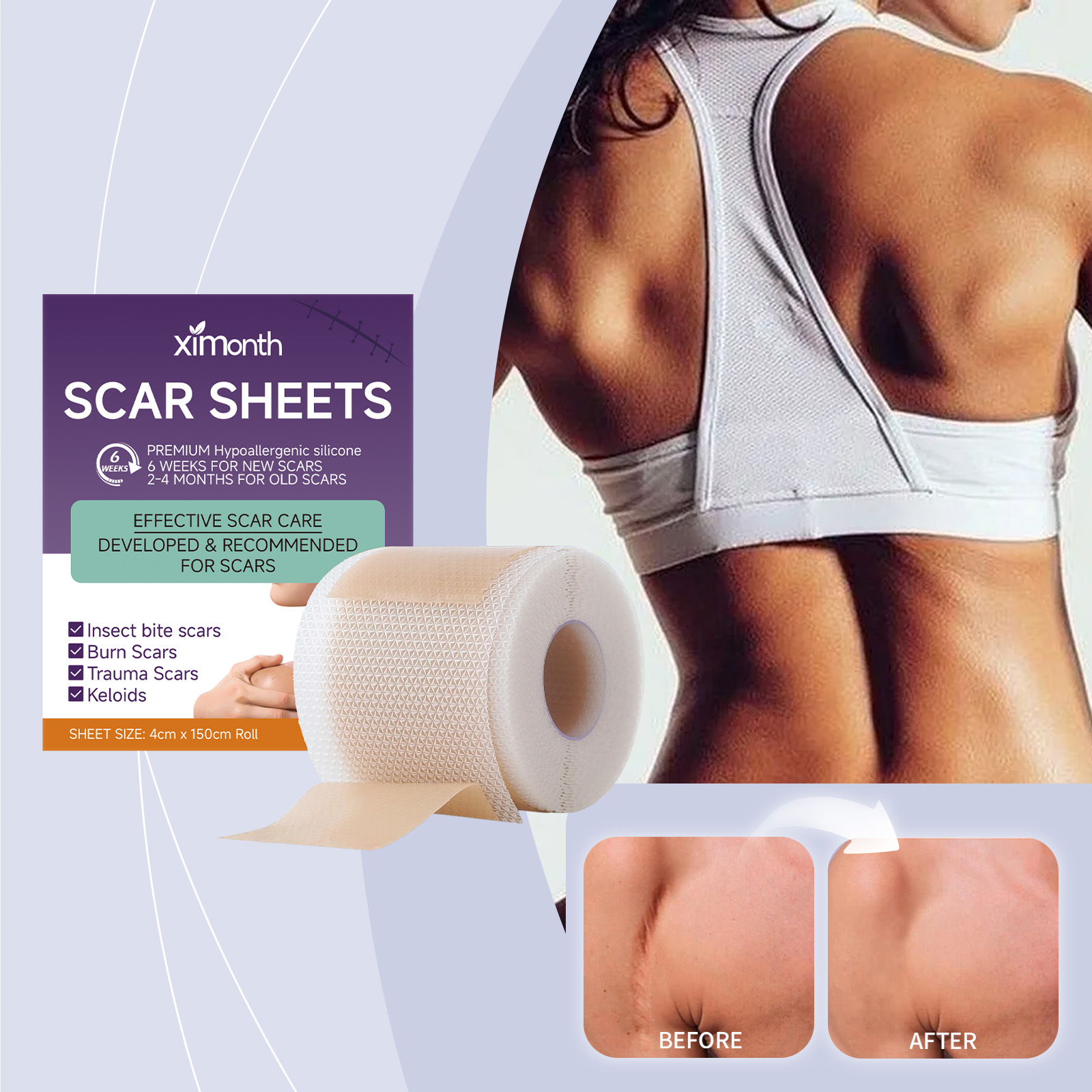 Silicone Body Care Patches Effectively Fade Skin Reduce Marks Gentle Ingredients Daily Care