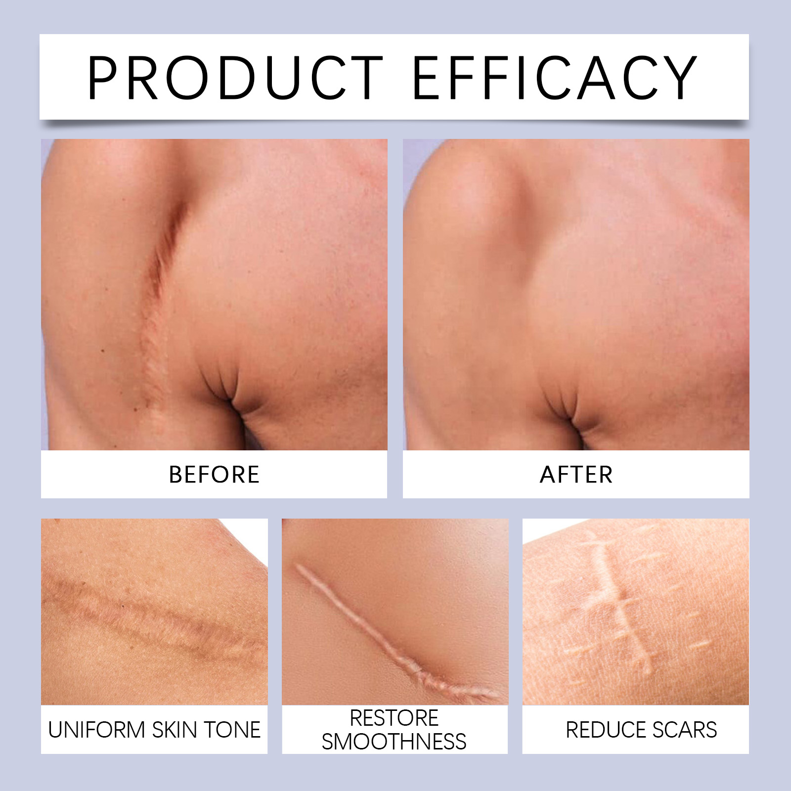 Silicone Body Care Patches Effectively Fade Skin Reduce Marks Gentle Ingredients Daily Care