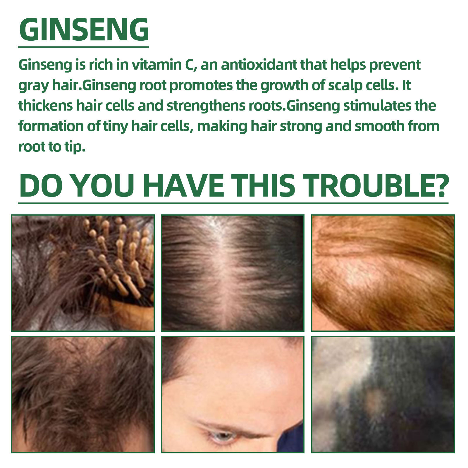 Hair Growth Spray Hyungang Korea Ginseng Hair Serum Spray Hair Regrowth Essential Oil Hair Essence for Women and Men