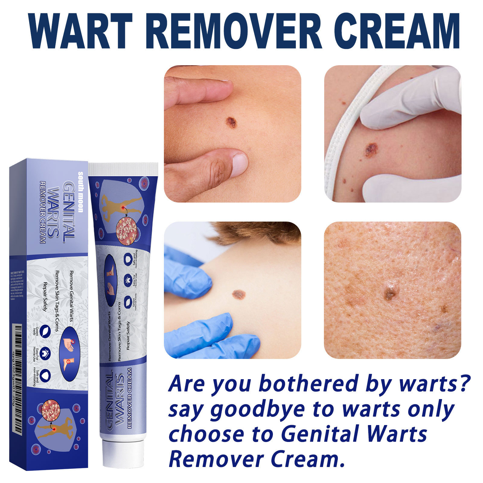 South Moon Skin Tag Remover Liquid Kit Wart and Tag Remover Wart Remover Fast Acting and Painless  for Body Anti Acne Face Cream Natural Safe Mole Remover