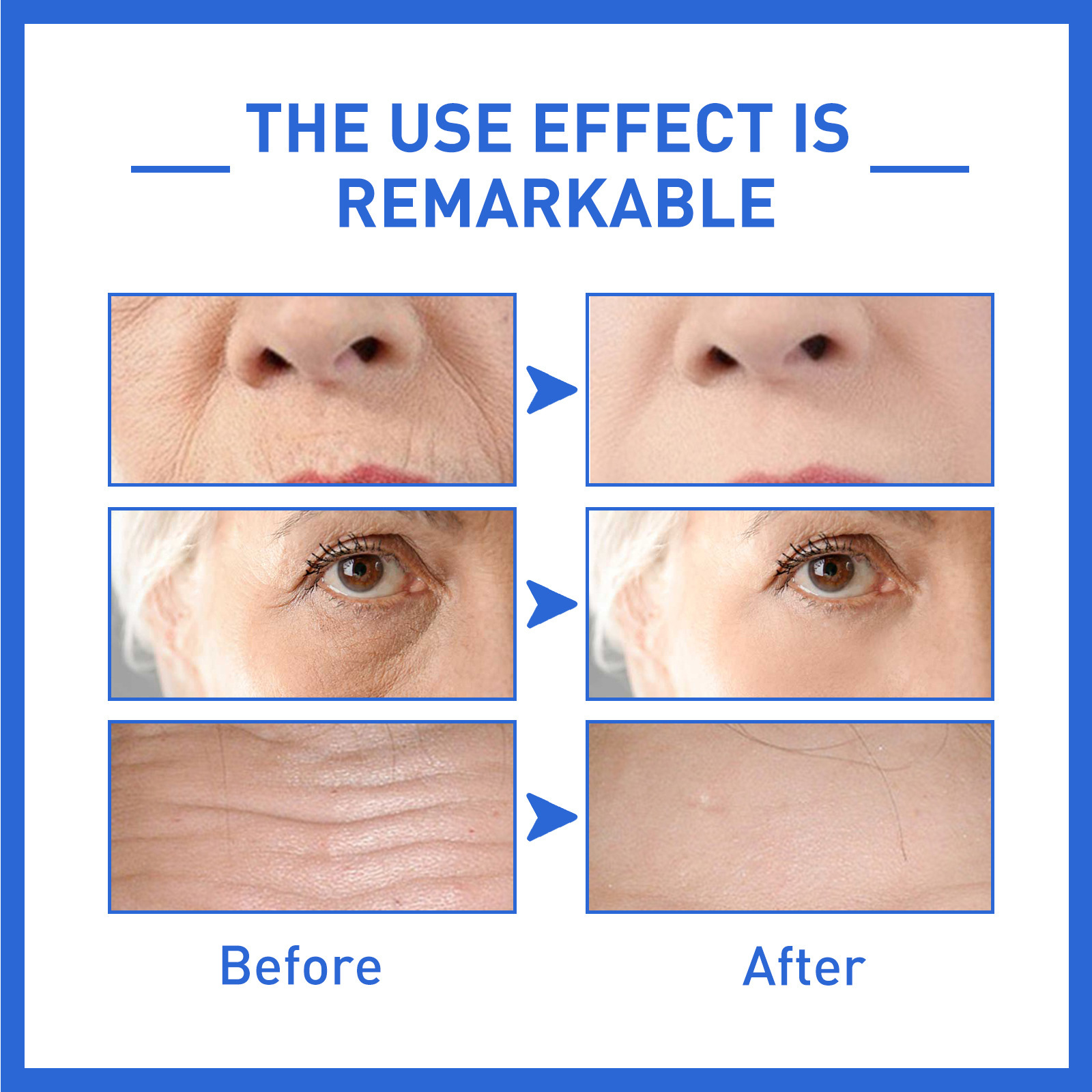 (1 PC) Collagen Facial Serum Skin Care Hyaluronig Face Lift Essence Anti Aging Essence Hydrating  Nourishing Face Moisturising for Dry Skin 30ml