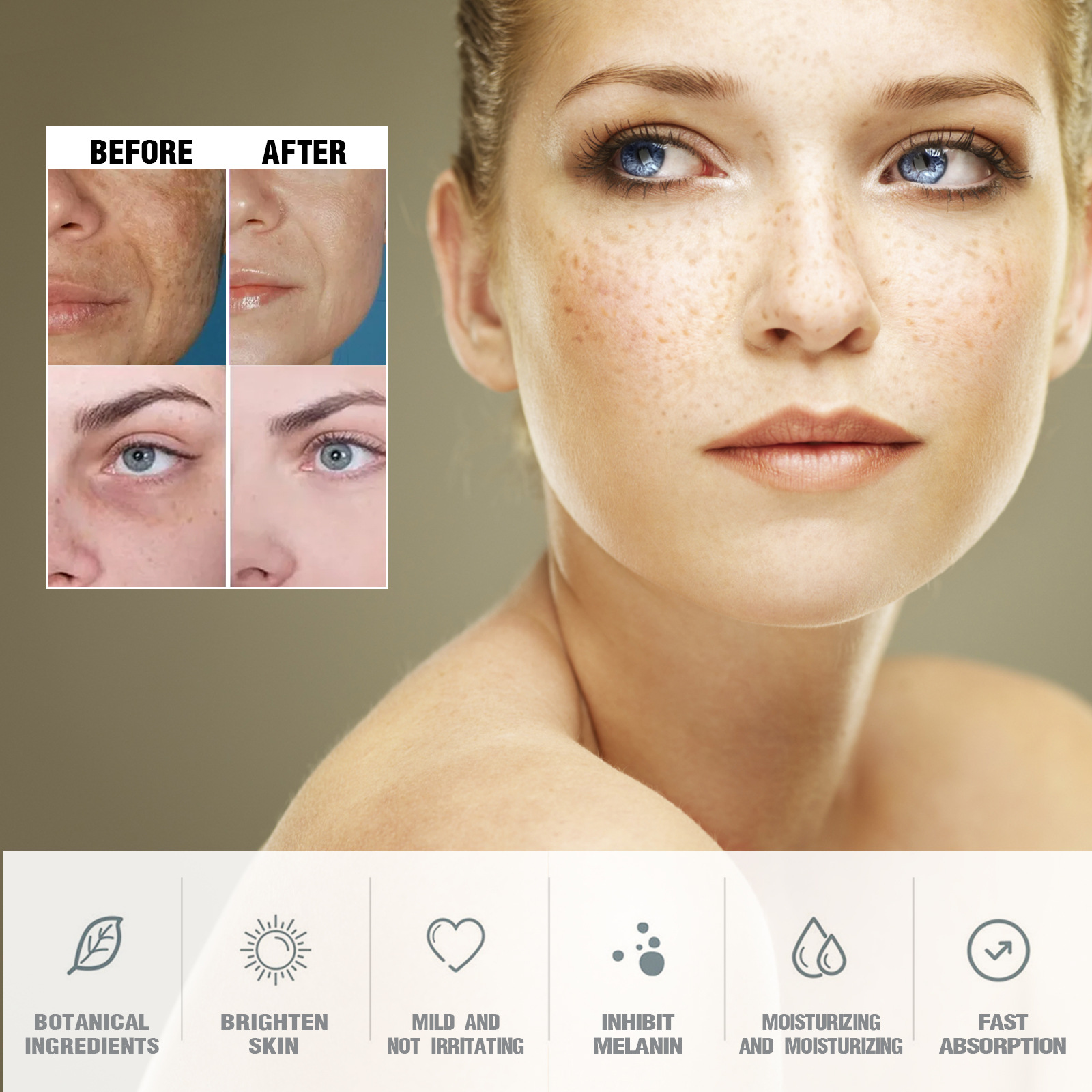 Dark Spots Remover Cream Lighten Melanin Melasma Chloasma Age Spots Sunburn Moisturizing Brightening Whitening Freckles Cream Remover Reduces Hyperpigmentation