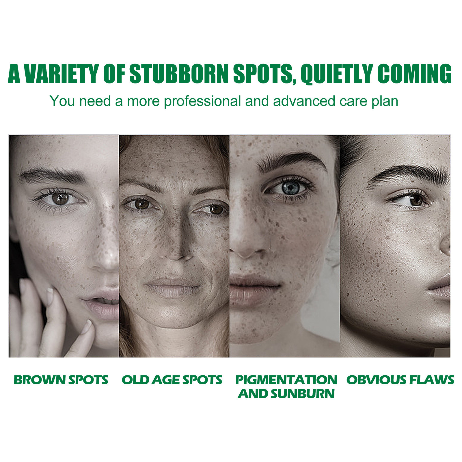 EELHOE Whitening Freckle Serum Fade Pigmentation Moisturizing Brightening Melanin Correcting Improve Dull Anti Aging Remove Dark Spots Face Care Essence