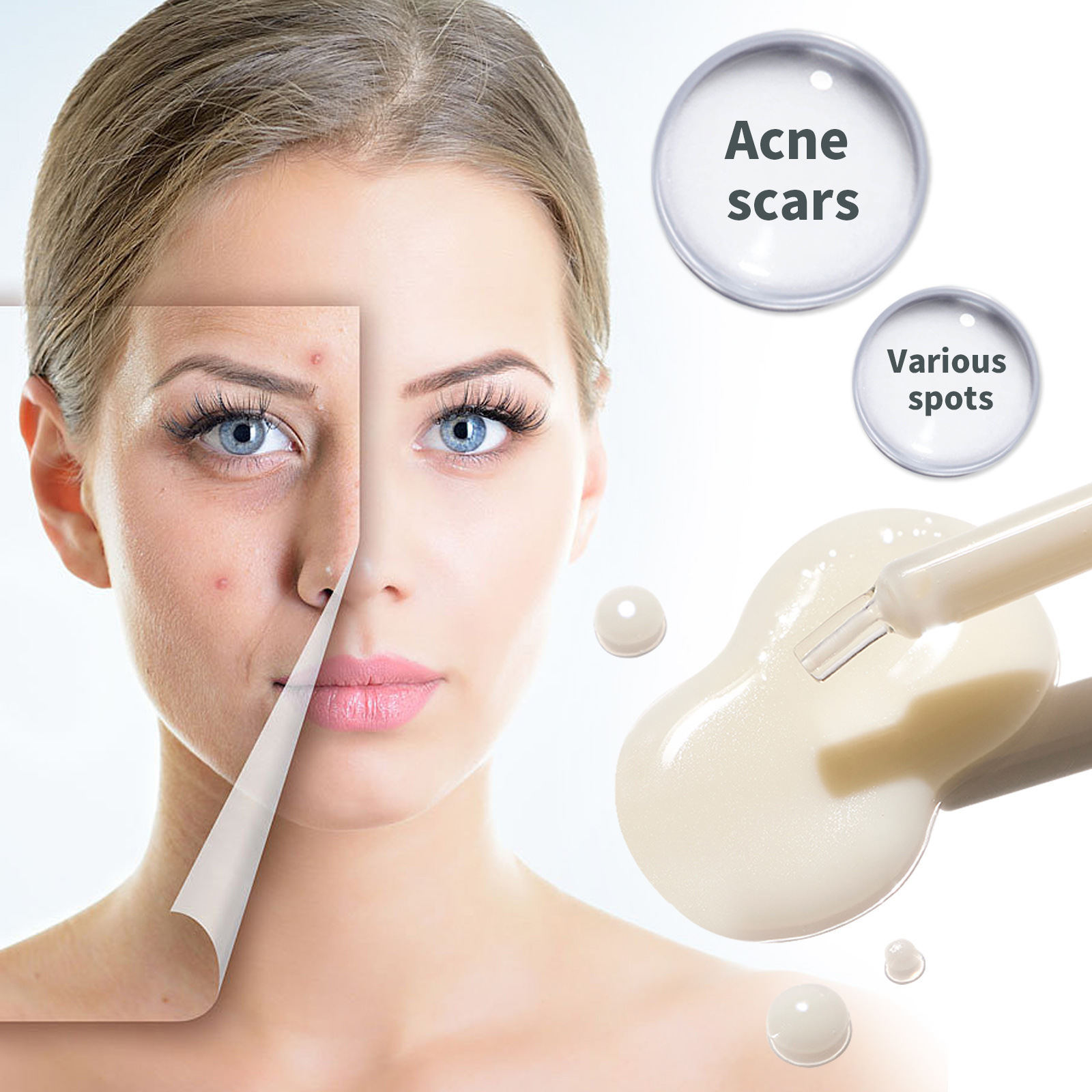 OUHOE Whitening Serum Remove Dark Sp-ots Pigm-entation Melasma Ac-ne Ma-rks Anti-aging Lift Firm Brightening Tender Skin Serum