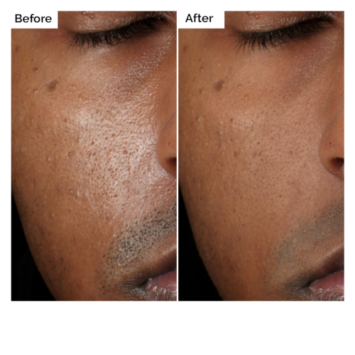 The Ordinary Aloe 2 Percent NAG 2 Percent Solution 30ml