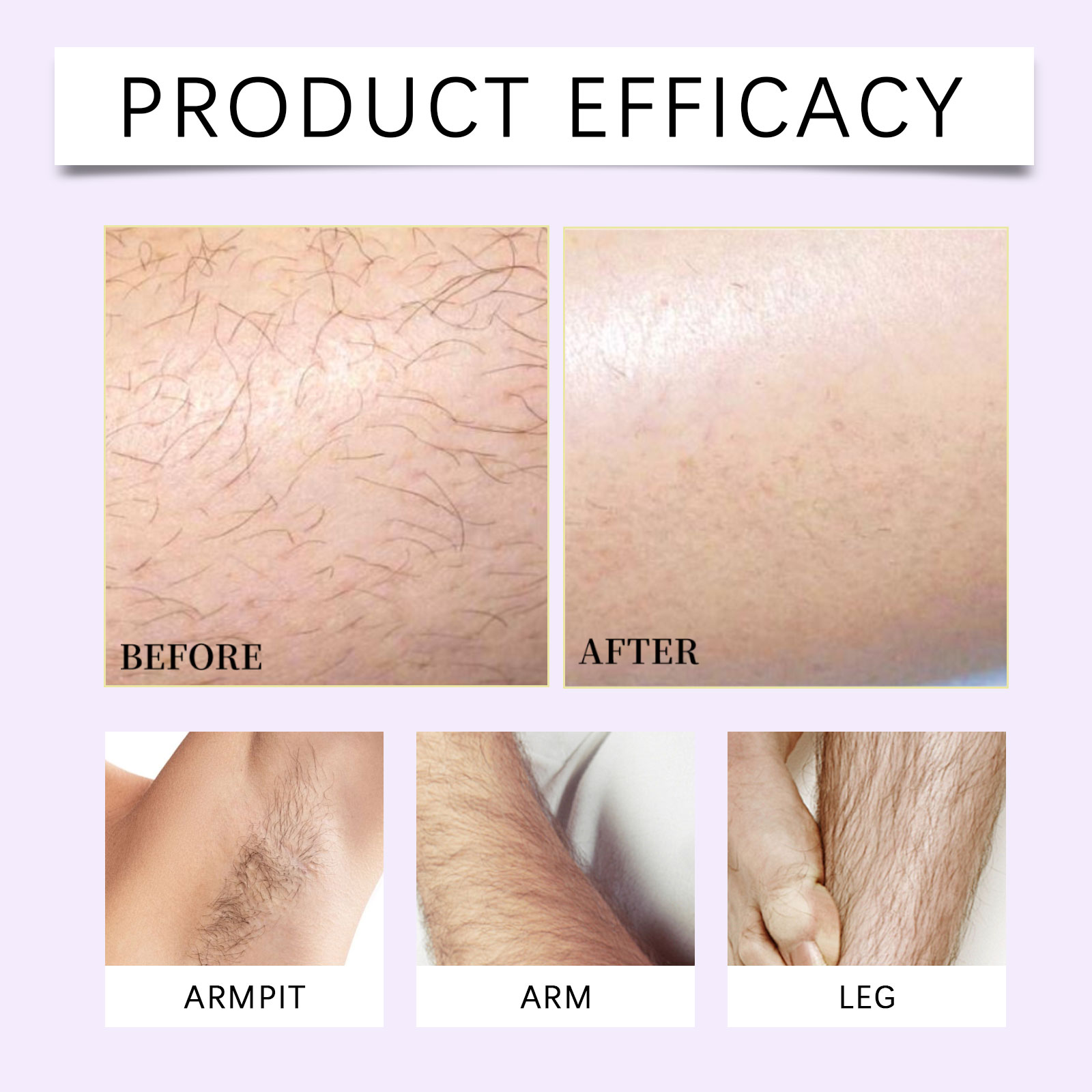 Mild Depilation Kit Gentle Care Smooth Hair Removal Silky Delicate Hydrated Skin Fresh Comfort Convenient Daily Use