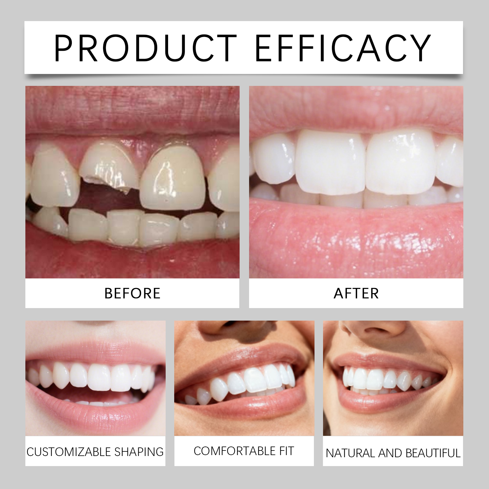Temporary Shaping Dental Gum Comfortable Natural Fitting Convenient Modifying Beautiful Daily Tooth Smile Repair Fill Material