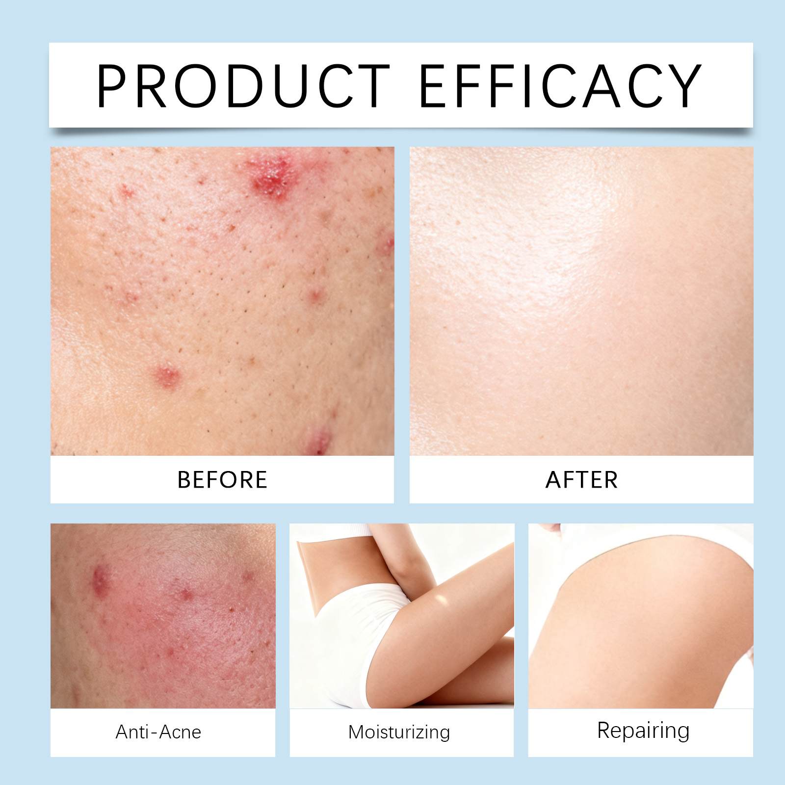 Buttocks Care Cream Daily Mild Nourish Body Skin Outline Refreshing Absorb Plumping Lotion