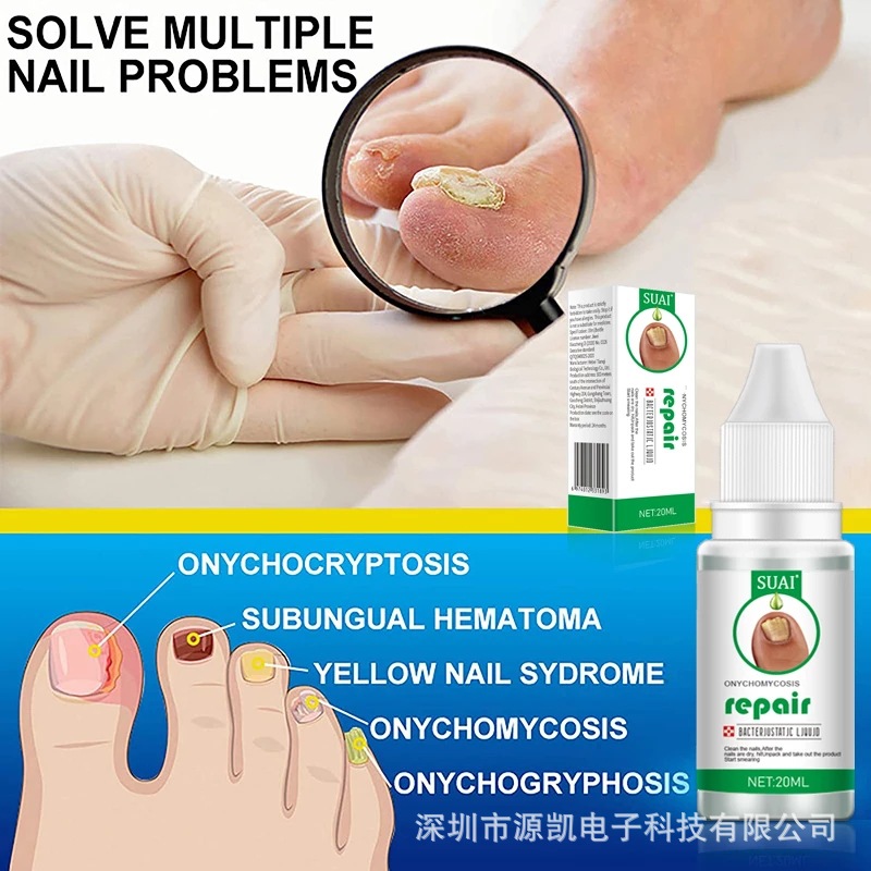 SUAI Nail Fungus Treatment Repair Liquid Foot Essence Serum Feet Care Products Anti Infection Onychomycosis Paronychia 20ml