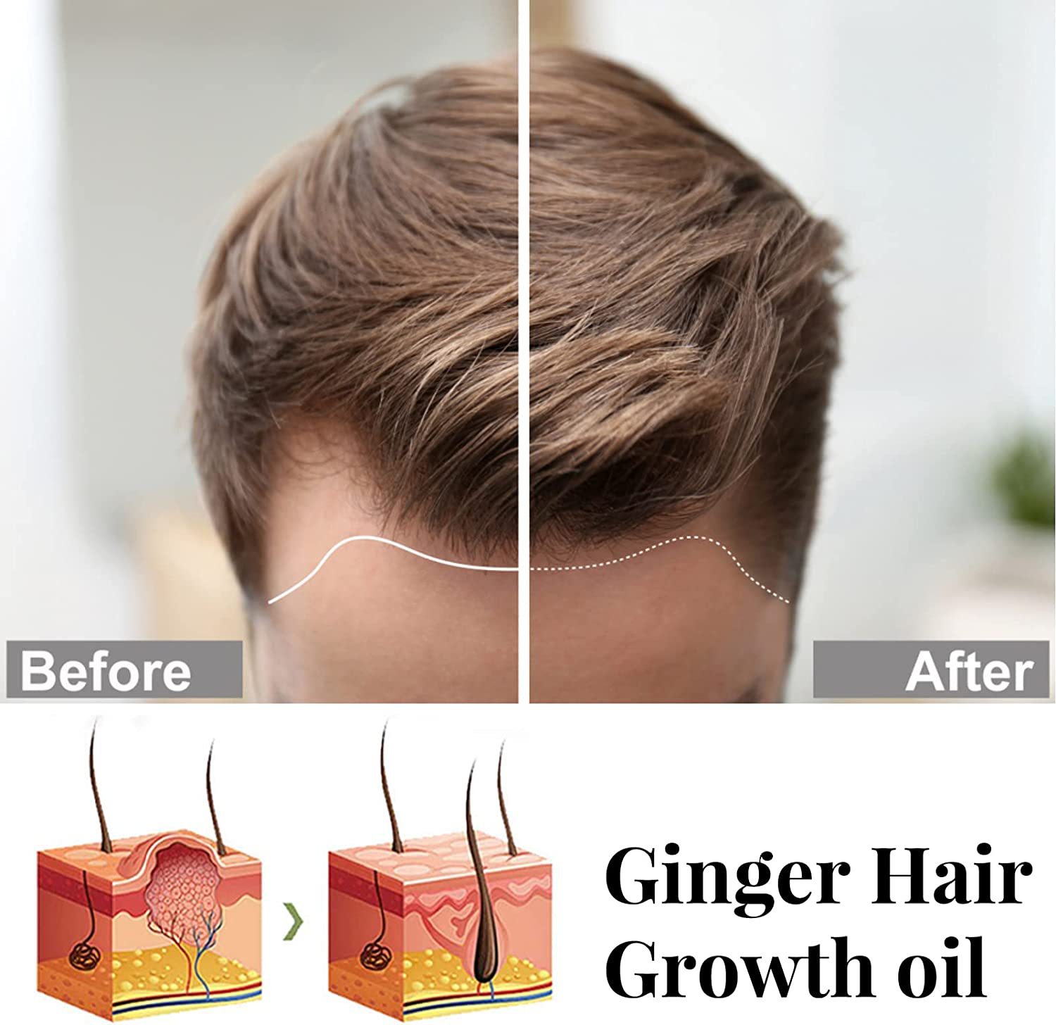 iBeaLee Anti-Hair Loss Spray Hair Growth Serum Tonic Deep Moisturize Repair Strengthen Hair Root Serum Anti-Frizz Care Scalp Nourish 20ml