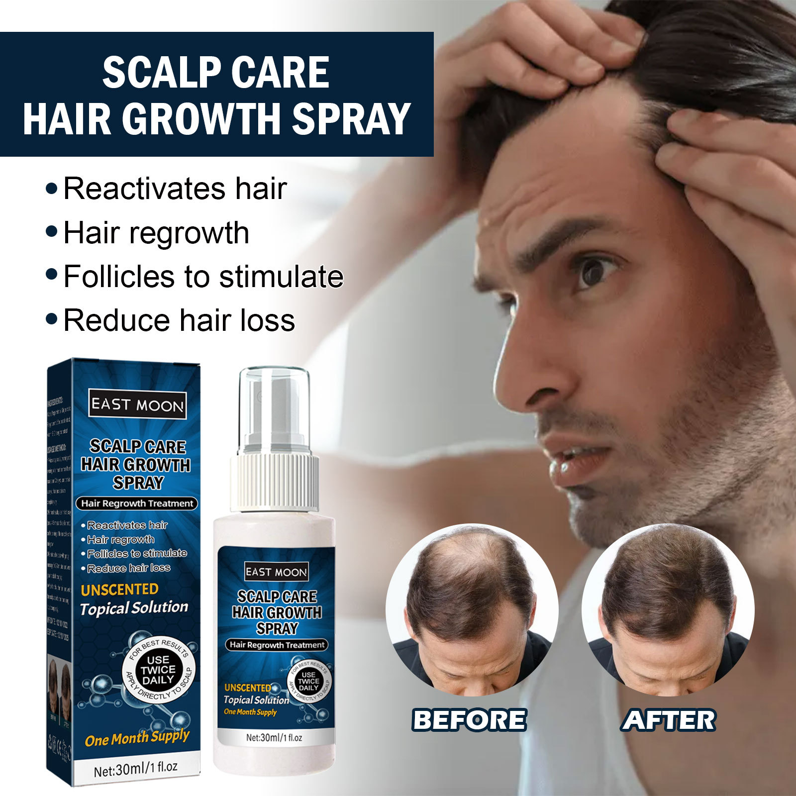 Hair Growth Solution Spray Hair Regrowth Thinning Serum Spray Hair Care Scalp Treatments Products for Stronger Thicker Longer Hair Anti Hair Loss 30ml