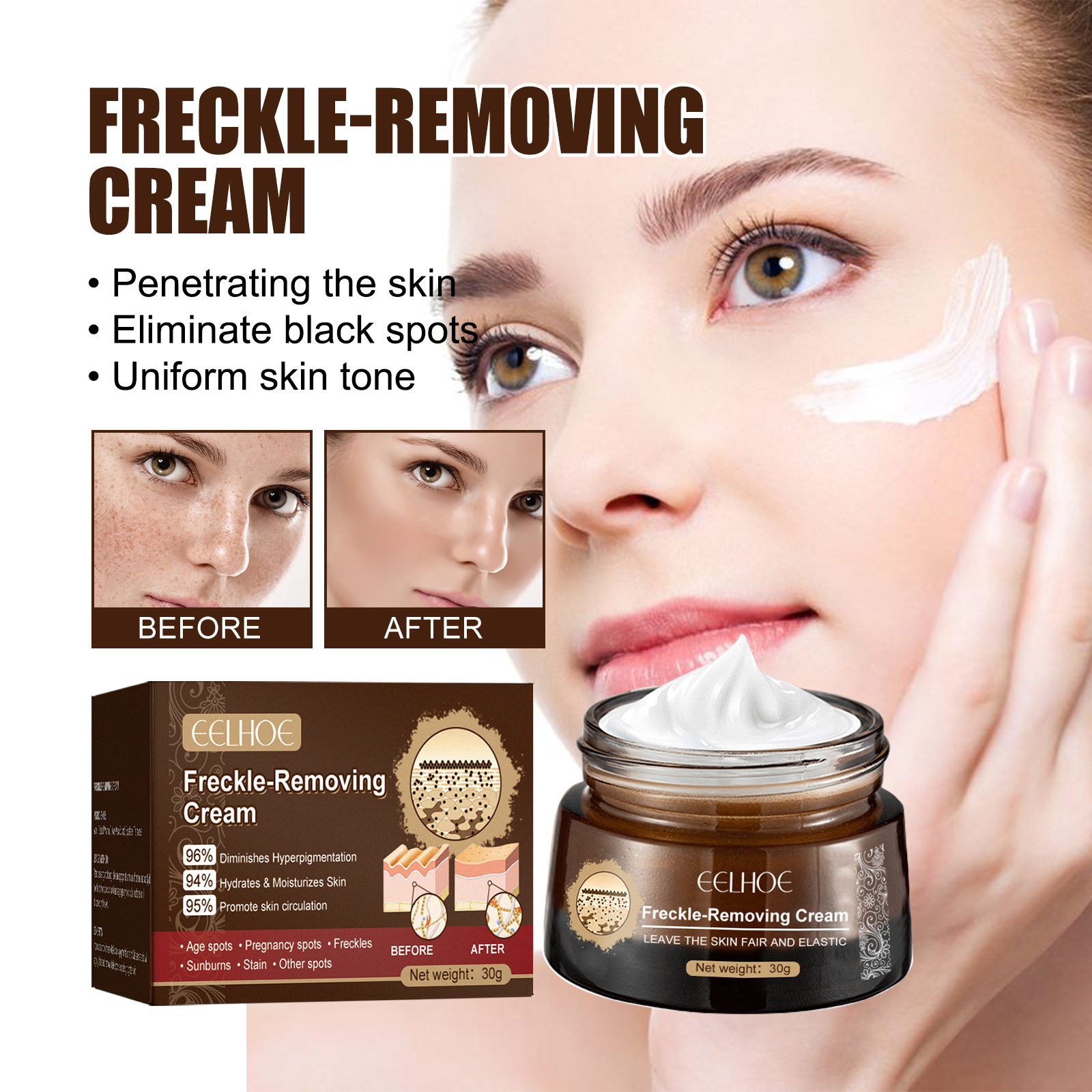 Freckle-Removing Cream Spot Off Freckle Whitening Fades Spots and Brightens Skin Tone Dark Spot Remover Moisturizing Skin Care
