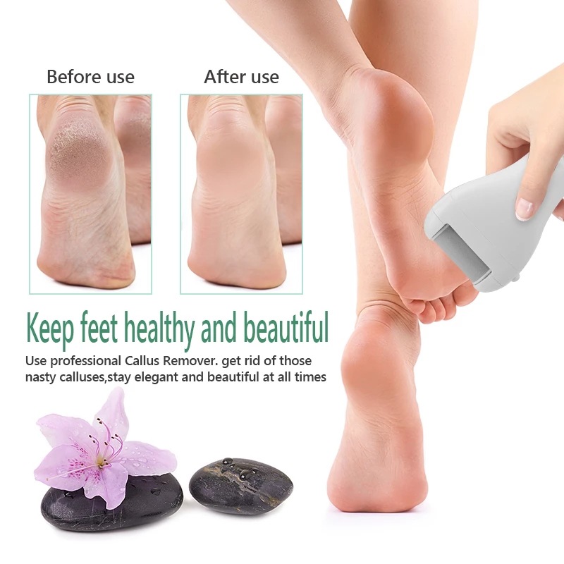 (Pink) Electric Foot File Rechargeable Remover with 3 Attachments