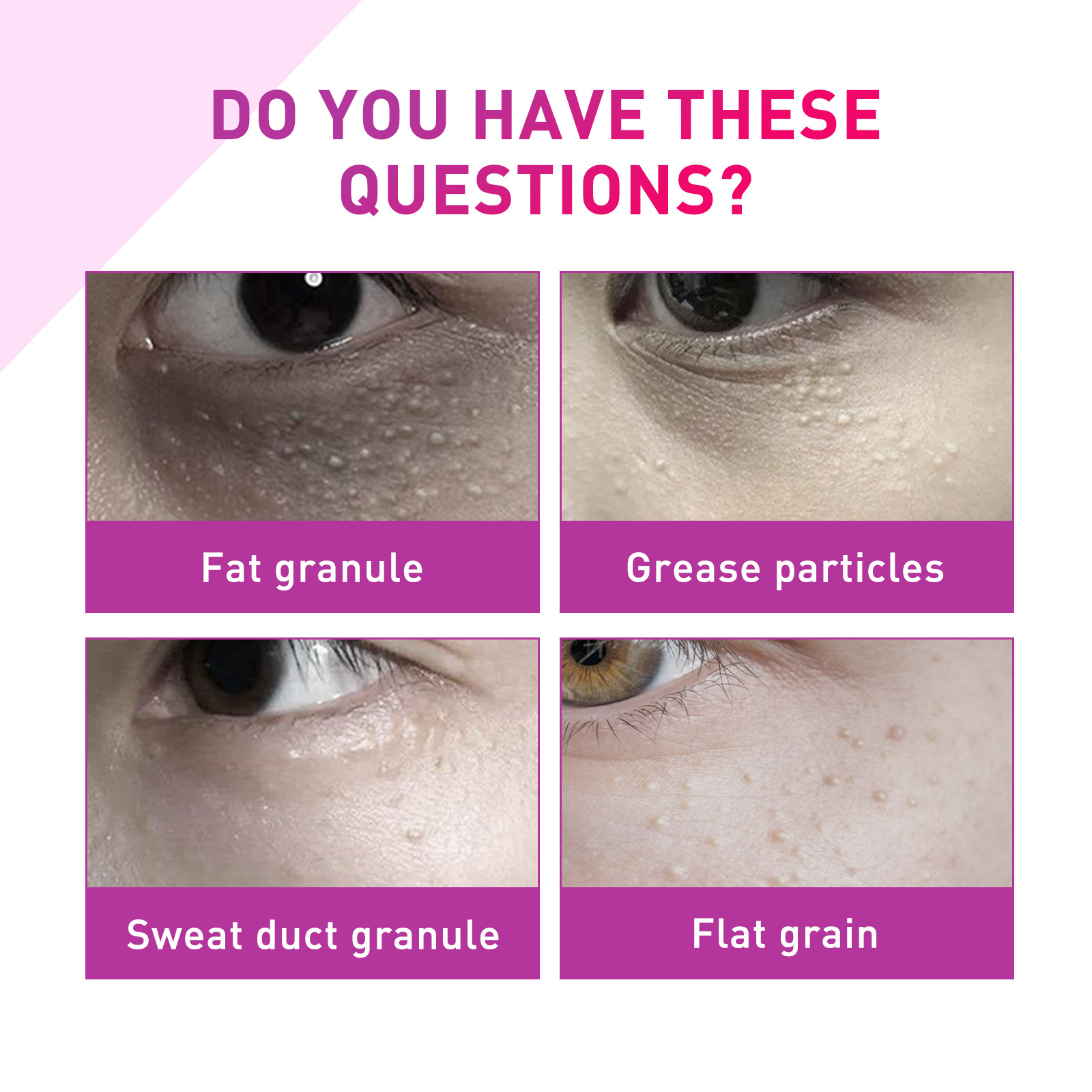 (1 PC) Fat Granules Removal Eye Serum Milia Spot Treatment Puffiness Repair Fine Lines Eye Bag Oil Control Moisturize Essence Eye Skin Soothing Remove Particles Around the Eyes