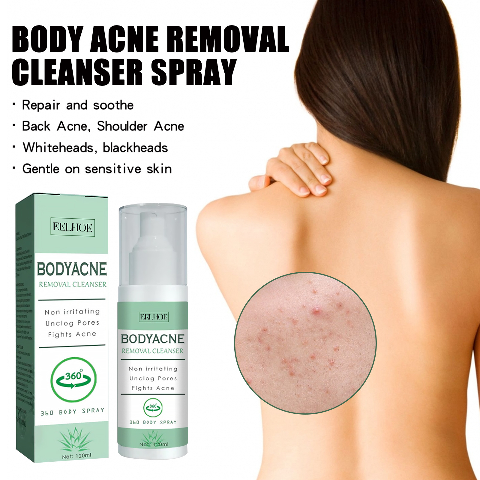 (1 PC) Body Acne Removal Cleanser Spray for Back and Arm Anti-acne Water Oil Balance Remove Redness Shrinking Pores Clean Body Pimple Remover Spray
