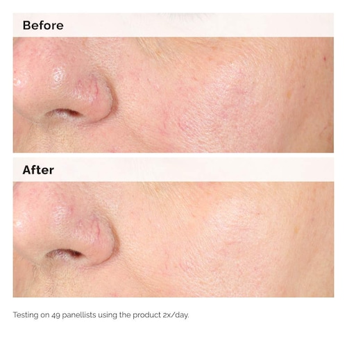 The Ordinary Alpha Arbutin 2 Percent HA Hyperpigmentation Serum 60ml