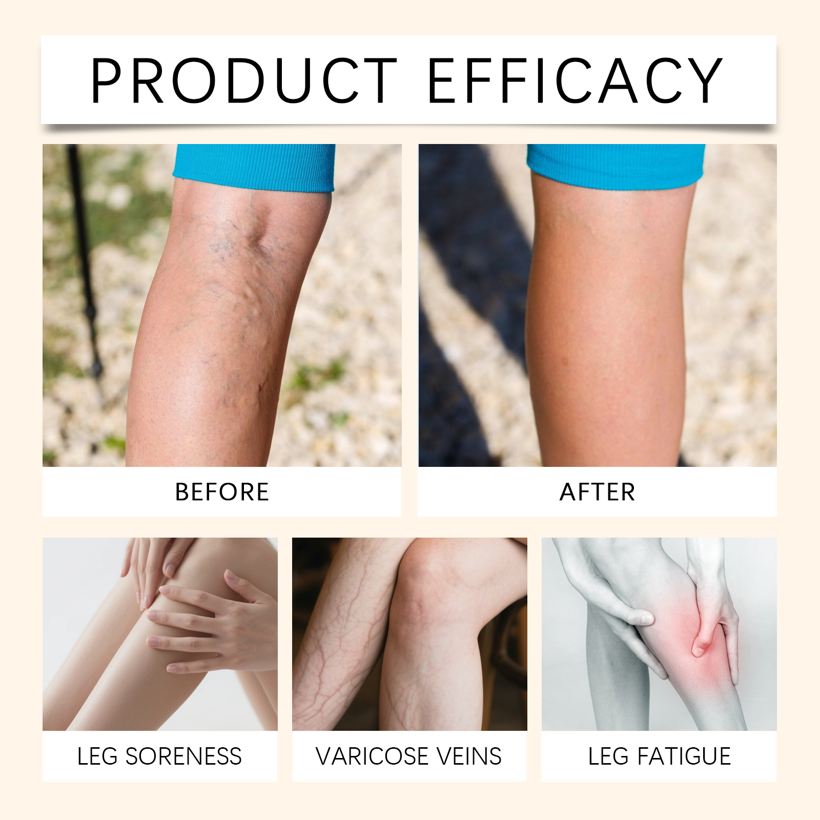 Leg Care Cream Mild Ingredients Nourish Leg Skin Comfort Daily Massage Smear Care