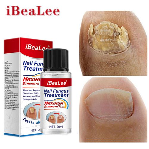 iBeaLee Nail Fungus Treatment Natural Safe And Effective Nail Repair Liquid