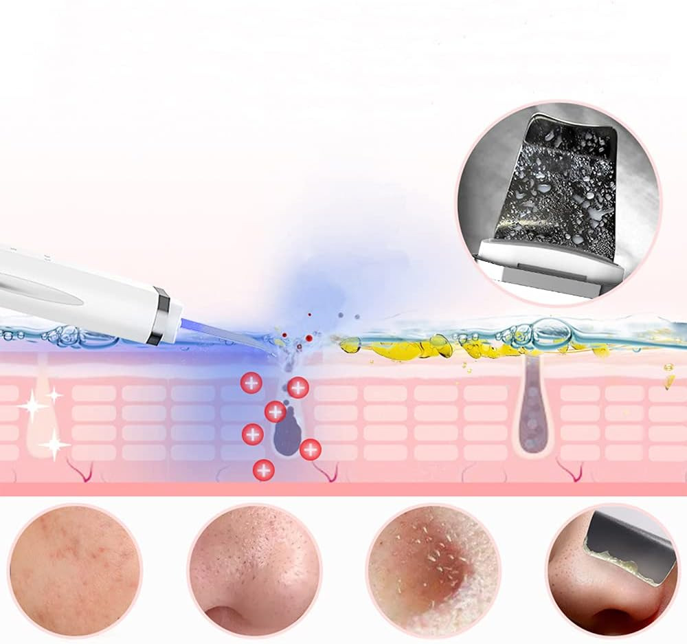 Skin Scrubber Blackhead Remover Facial Skin Spatula Ultrasonic Cleaner Pore Acne Cleaner Tool Waterproof Facial Scraper Skin Care Device Deep Cleaning