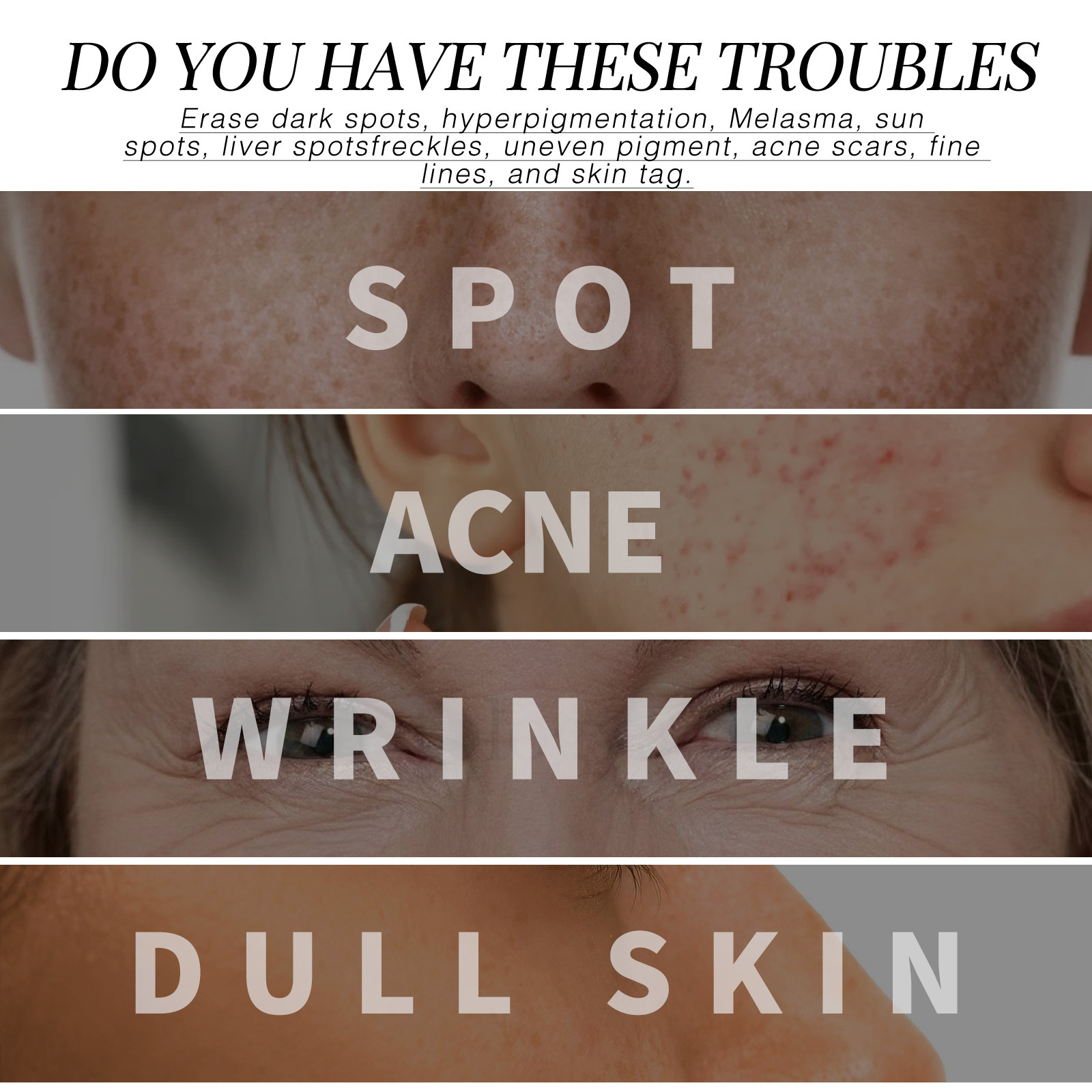 Whitening Face Cream Kojic Acid Dark Spots Corrector Remove Pigment Melanin Anti Wrinkles Aging Firming Moisturizing Nourishing Brightens Repair Skin