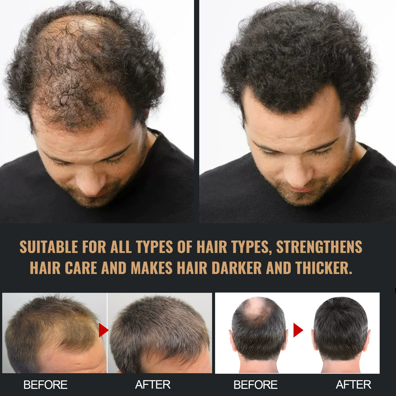 Shampoo for Fast Hair Growth Repair Nourishment Root 100ML