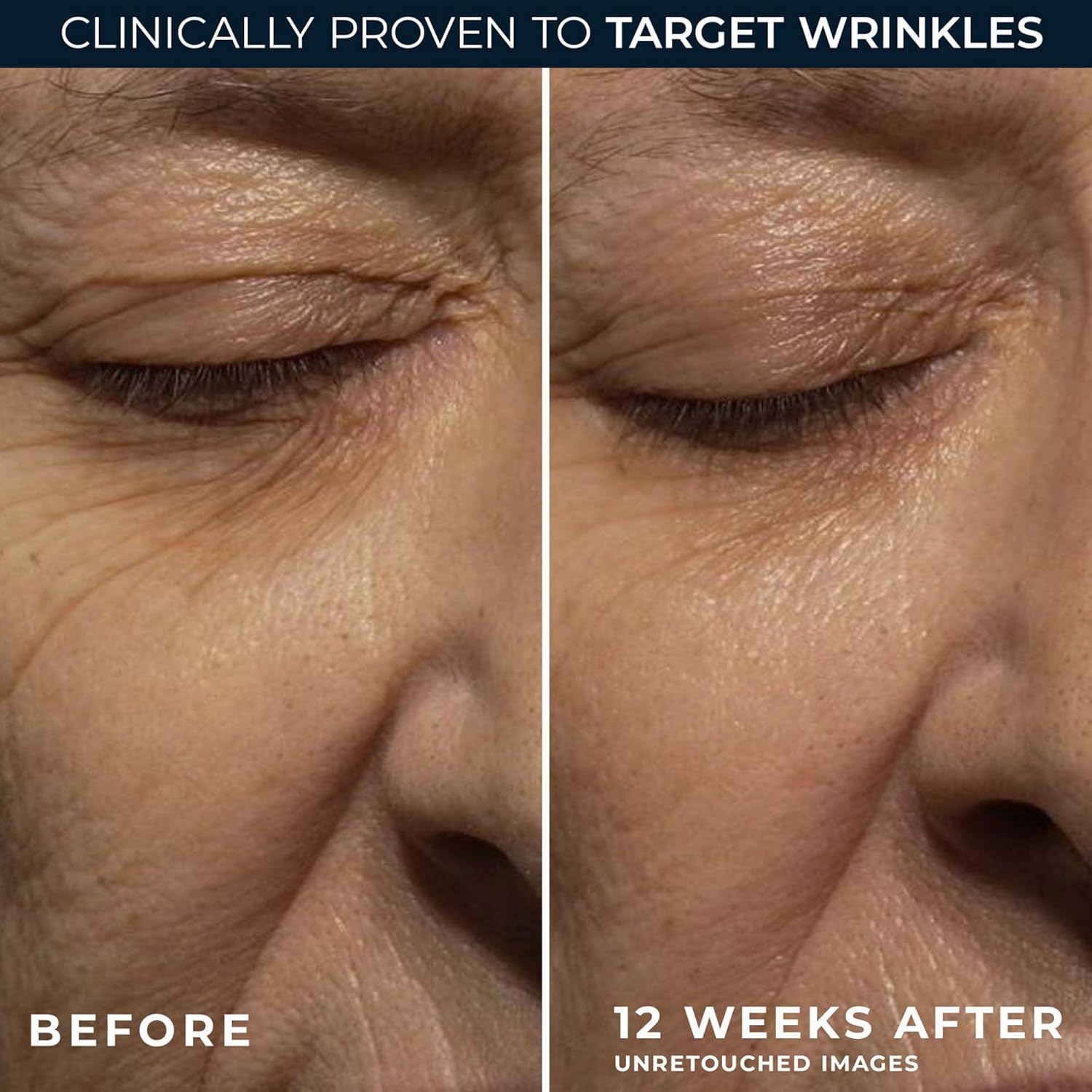 RoC Retinol Correxion Wrinkle Correct Night Cream Wrinkle Reducing Moisturiser for Face 30ml