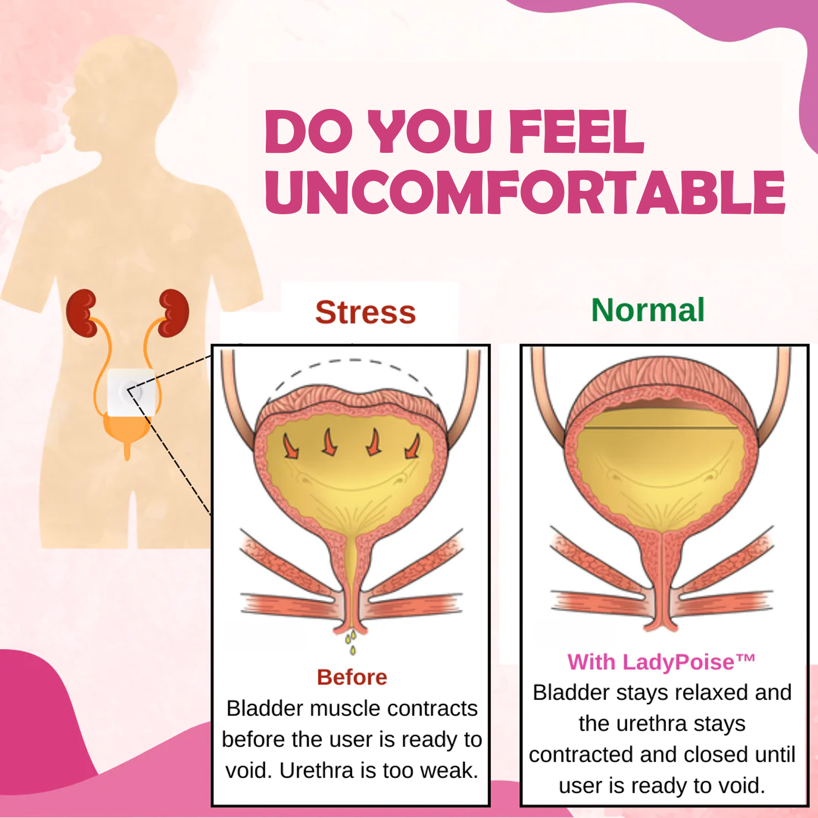 Bladder Control Support Patches Women's Incontinence Care Herbal Body Plasters