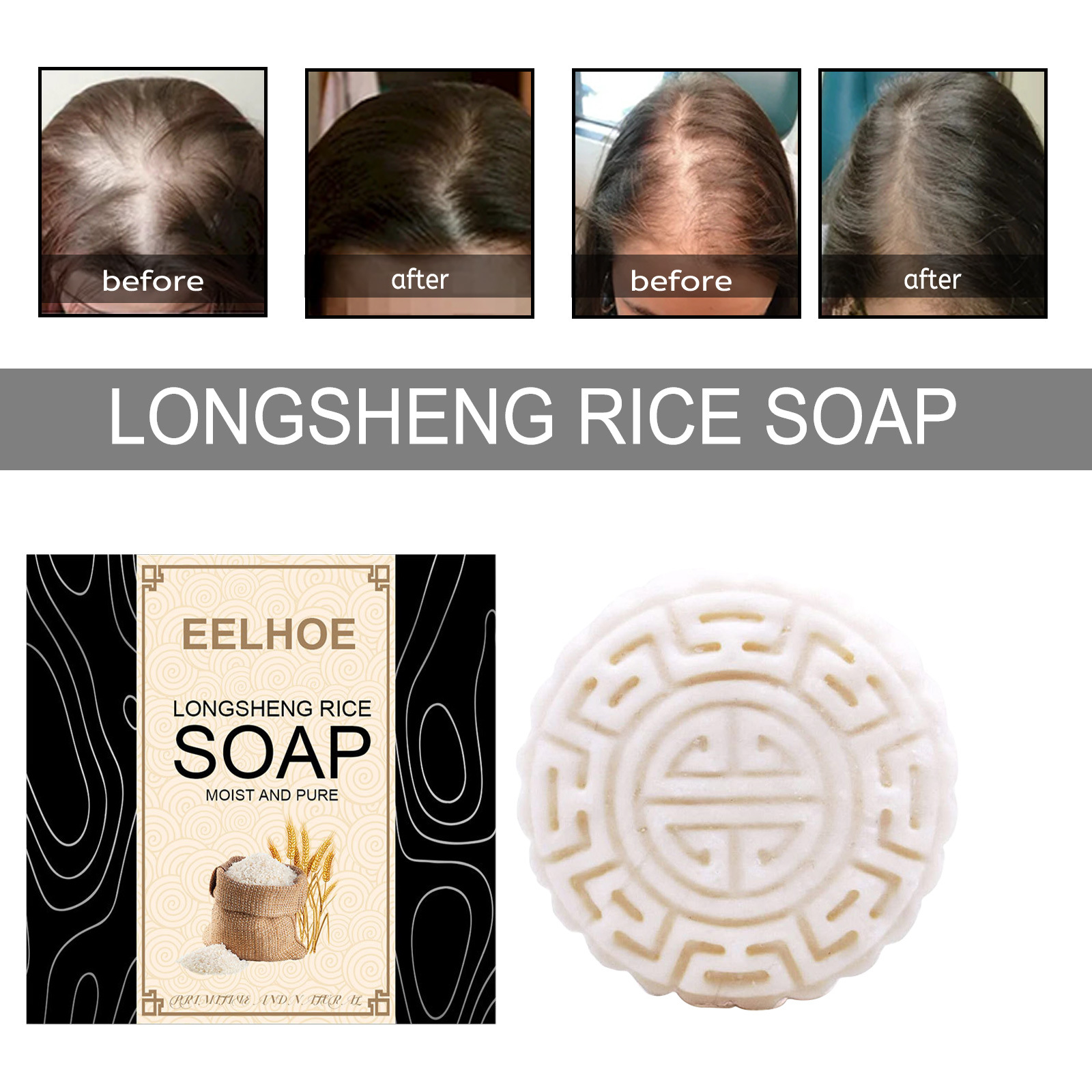 Rice Water Shampoo Soap Solid Hair Growth Shampoo Bar Hair Moisturizing Anti Hair Loss Treatments