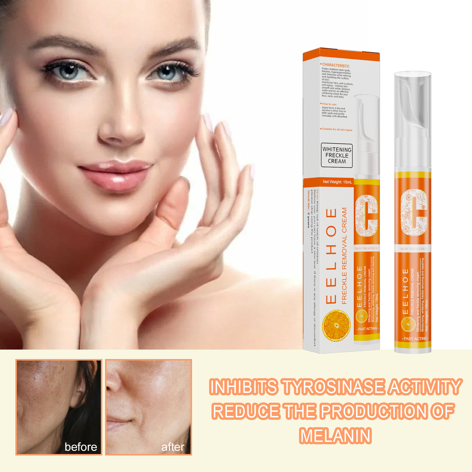 Whitening Freckles Cream Anti Freckle Pen Melanin Spots Cream Vitamin C Blemish Removal  Hydrating
