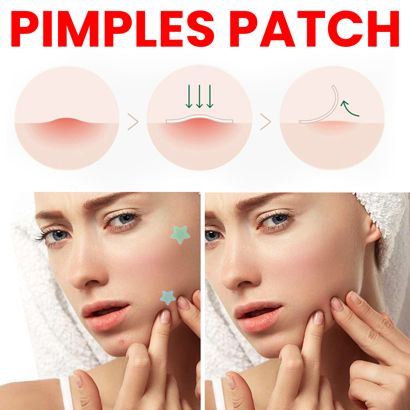 Hot Selling 200pcs Colorful Star Pimple Patches Pimple Removal Acne Pimple Patch
