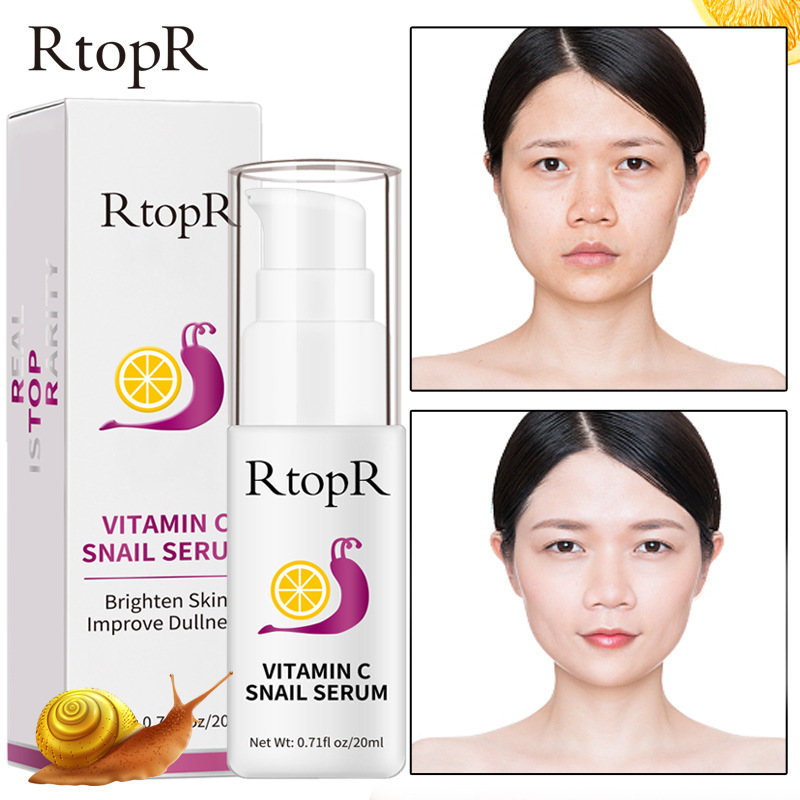 VC Snail Essence Face Serum Brightening Moisturizing Skin Repair Daily Facial Treatment 20ml