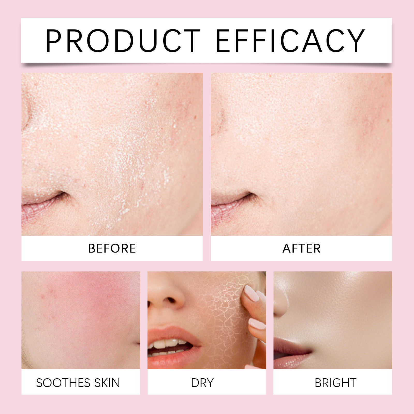 Nicotinamide Essence Liquid Mild Hydrating Moisturizing Soft Refined Skin Daily Care Facial Body Gentle Nourishing Smoothing