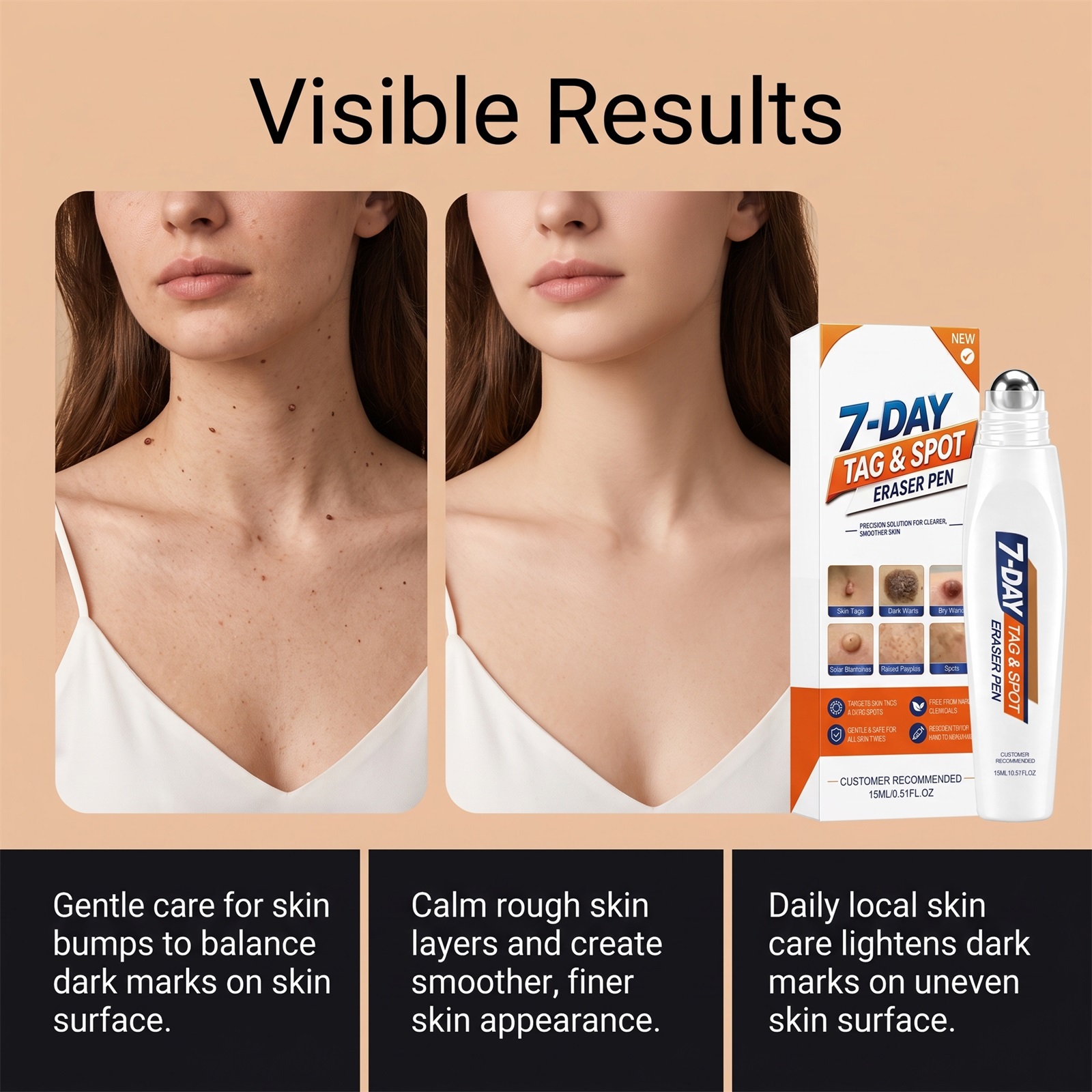 Skin Care Pen Spot Application Cleansing Brighten Complexion Smooth Nourish Skin Refreshing Body Partial Area