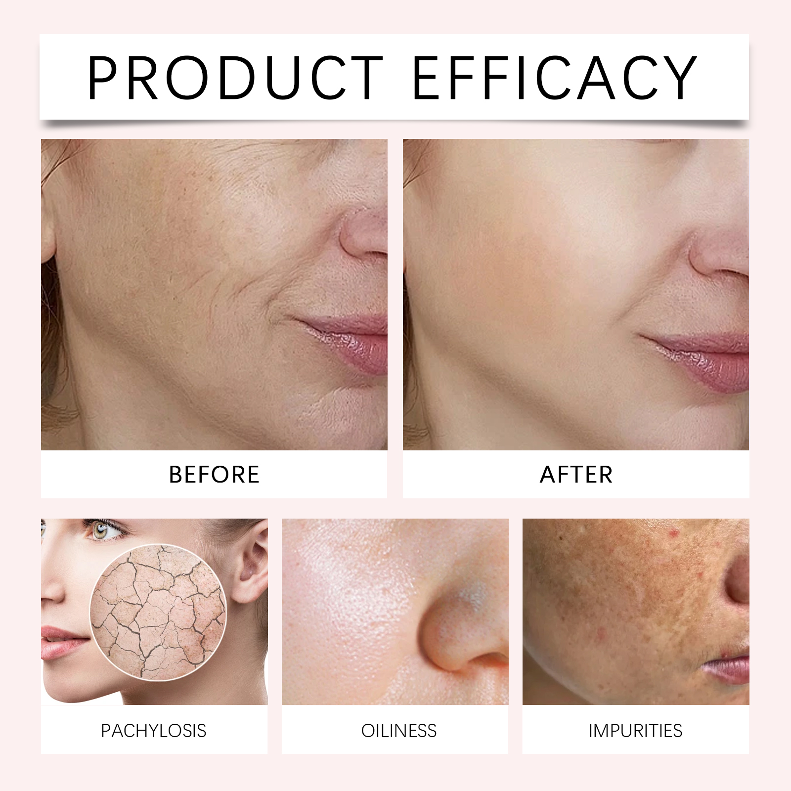 Moisturizing Anti Wart Peel Off Mask Deep Cleansing Hydrating Firming Skin Facial Care
