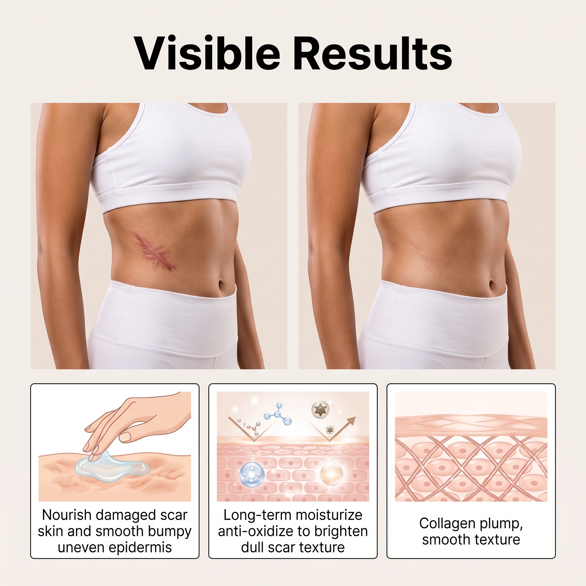 Skin Soft Patch Comfortable Fit Skin Friendly Breathable Delicate Smooth Light Conceal Defects Care Body Skin