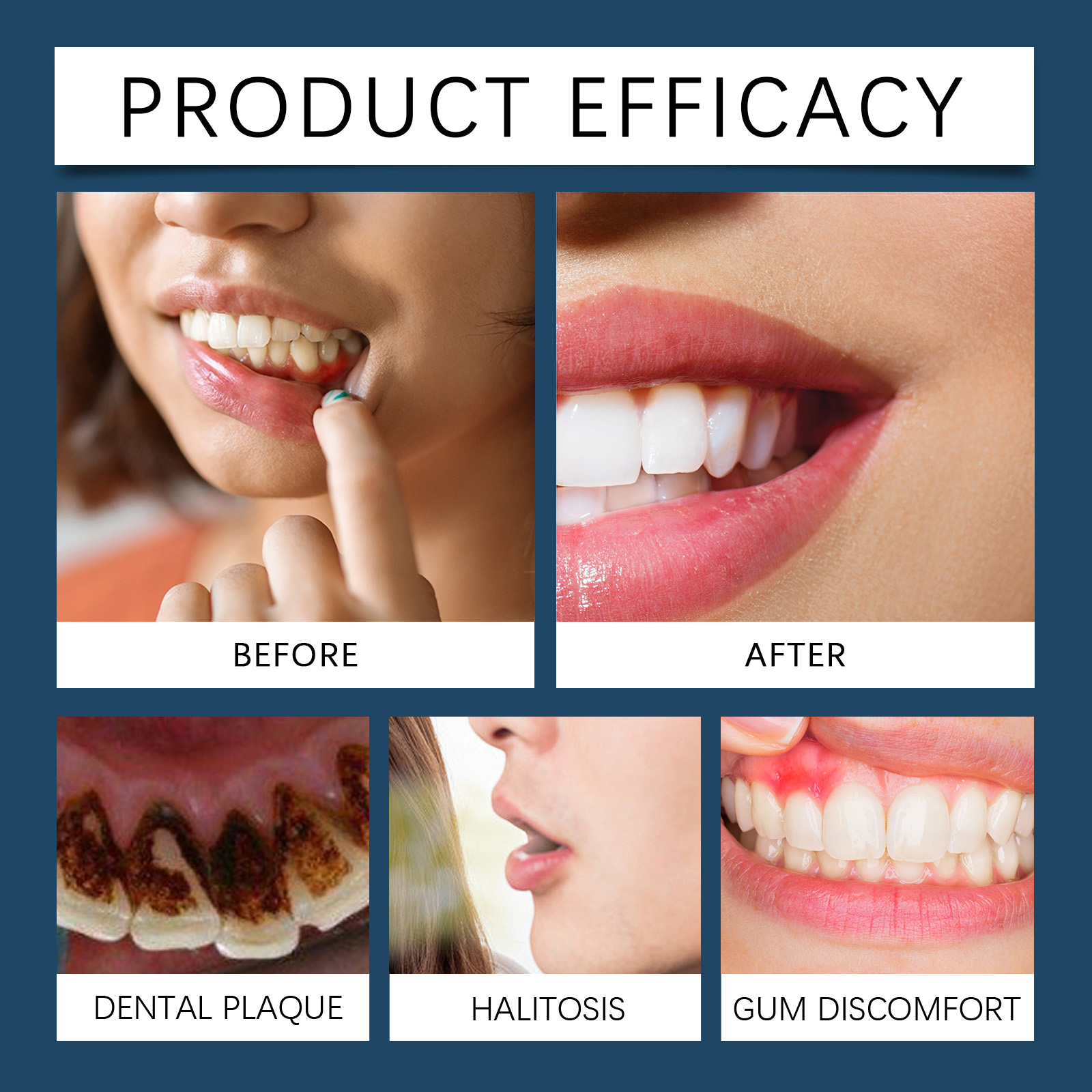Teeth Care Gel Gentle Care Clean Comfort Teeth Fresh Natural Bright For Daily Use
