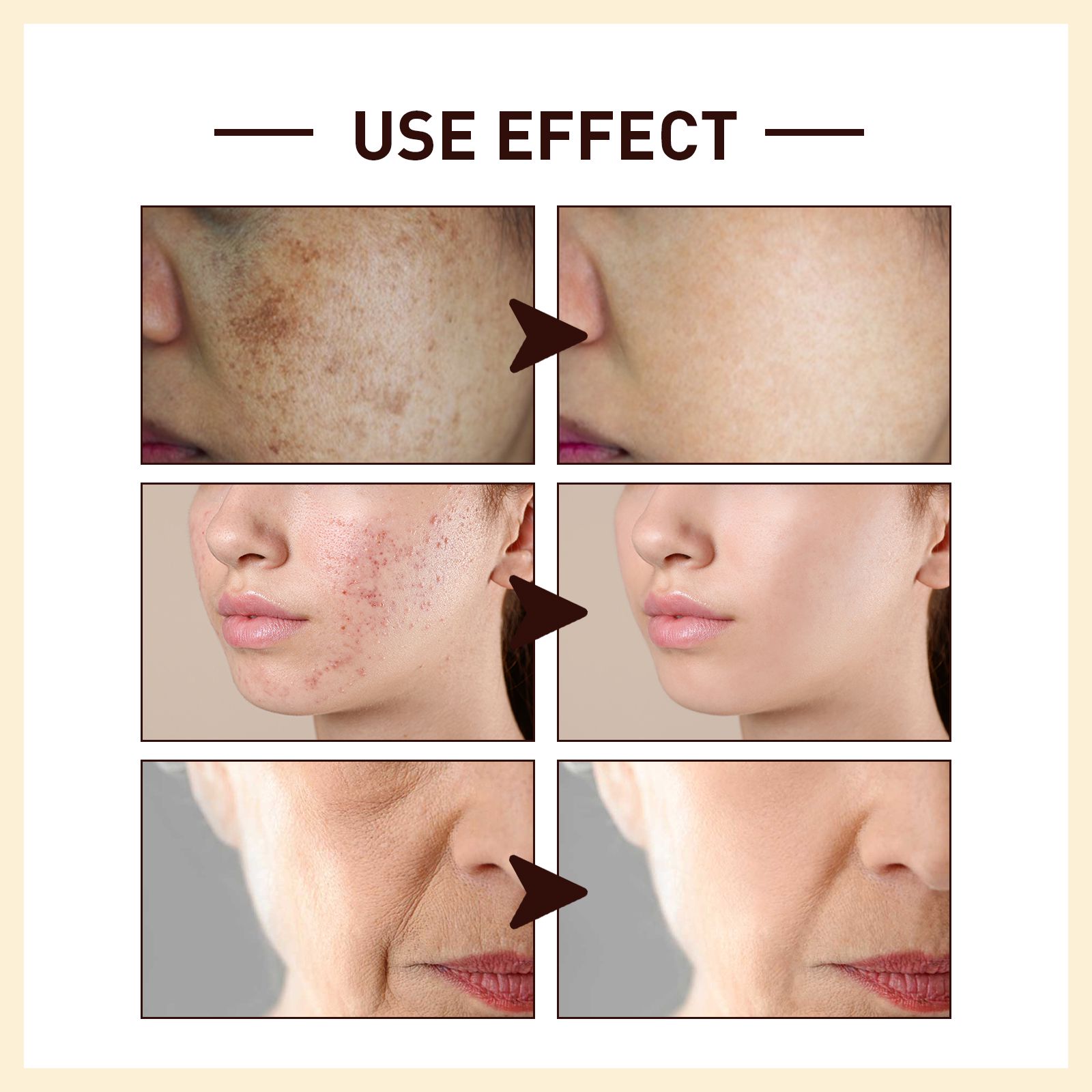 Rice Anti Wrinkle Serum Hydrating Firming Brightening For Daily Face Care 30ml