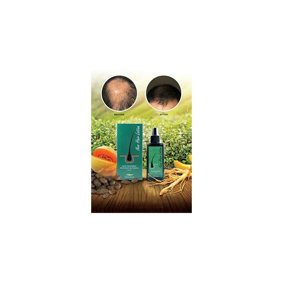 Neo Hair Lotion + 540 Roller Gift Herbs 100% Natural Treatment Spray Stop Hair Loss Root